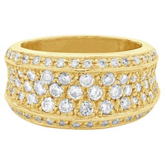 Band Rings