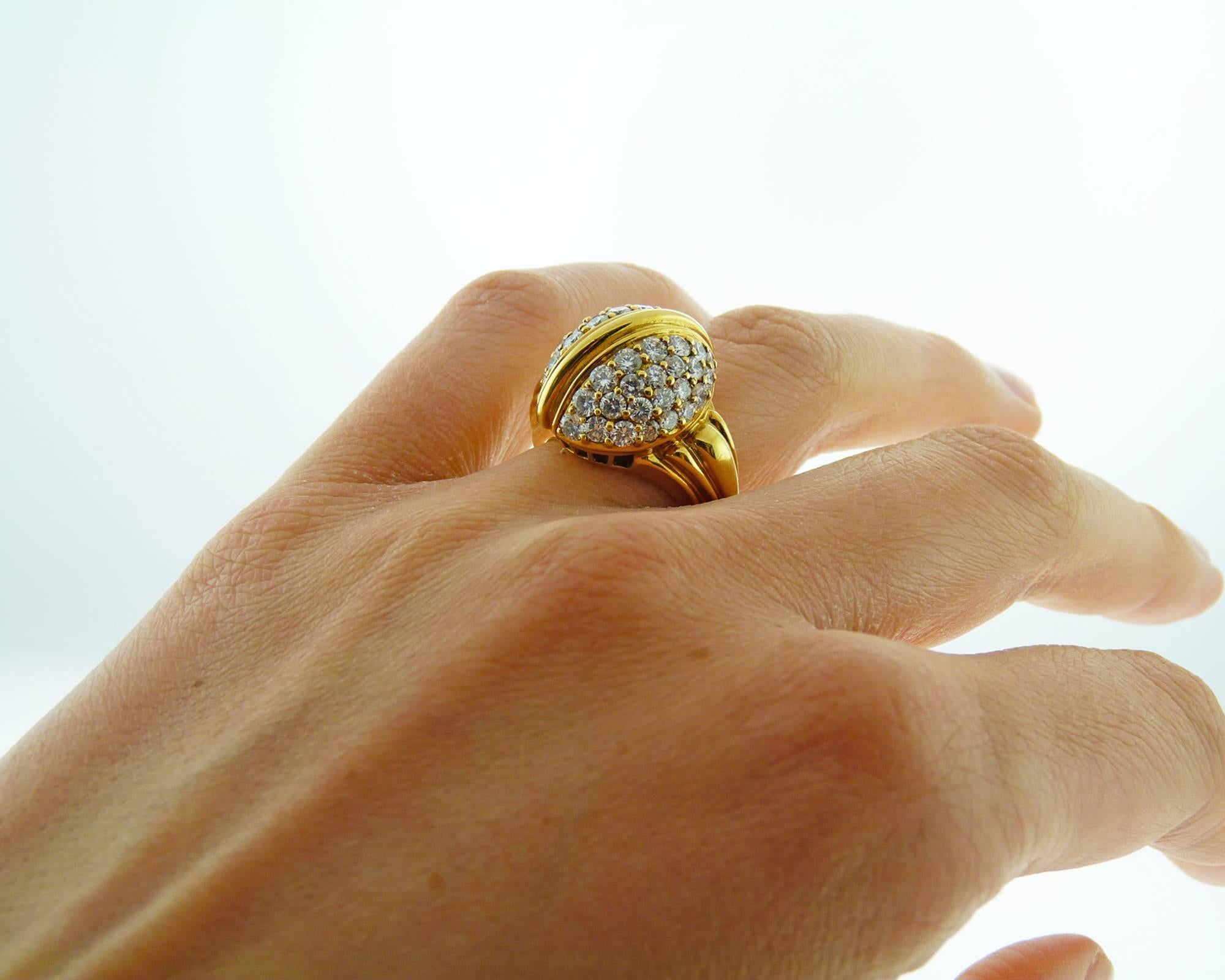 24 karat vs 18 karat gold