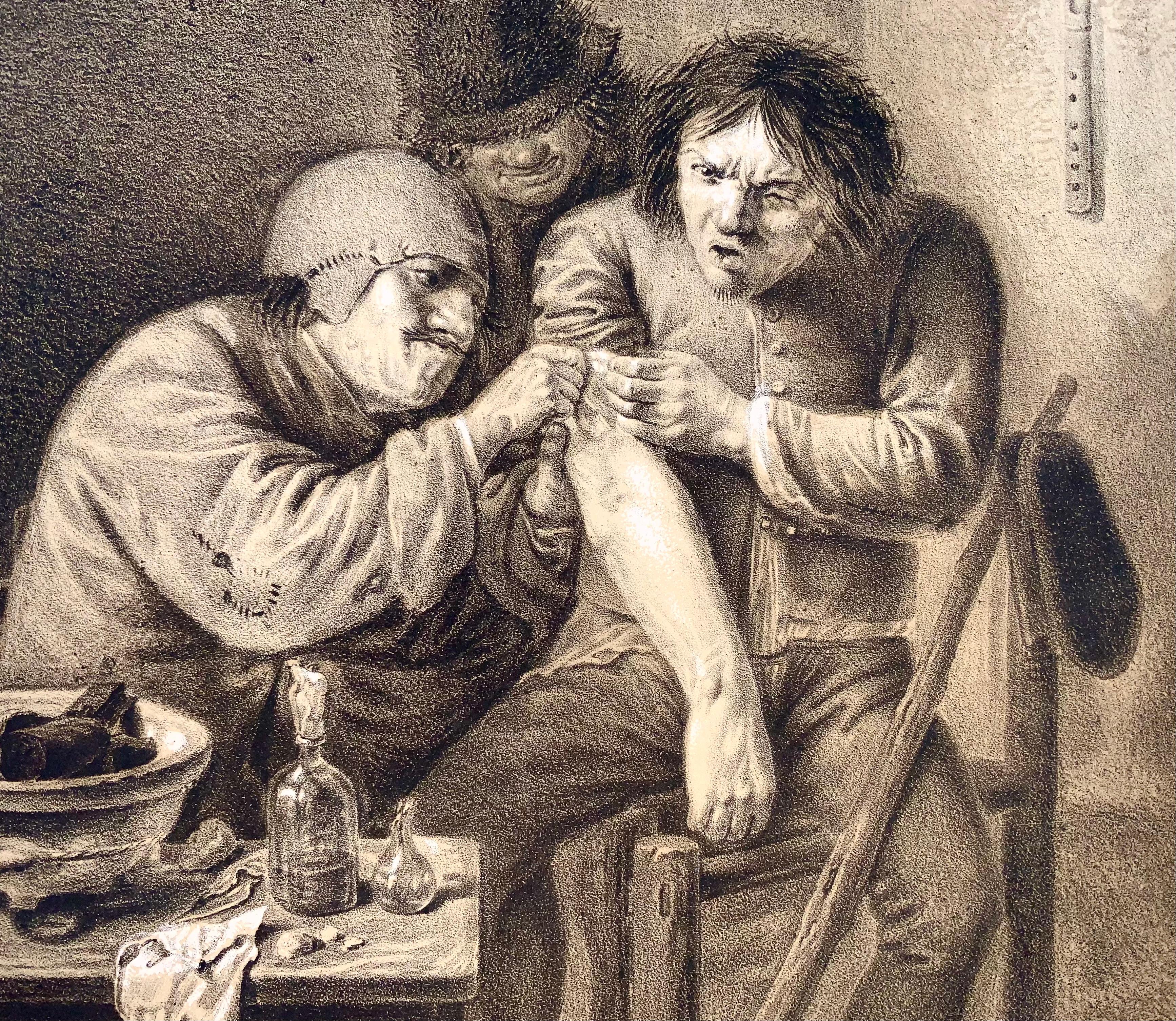1810c Medizin, Surgeon, N. Strixner nach A. Brouwer, Incunabula der Lithografie im Zustand „Gut“ im Angebot in Norwich, GB
