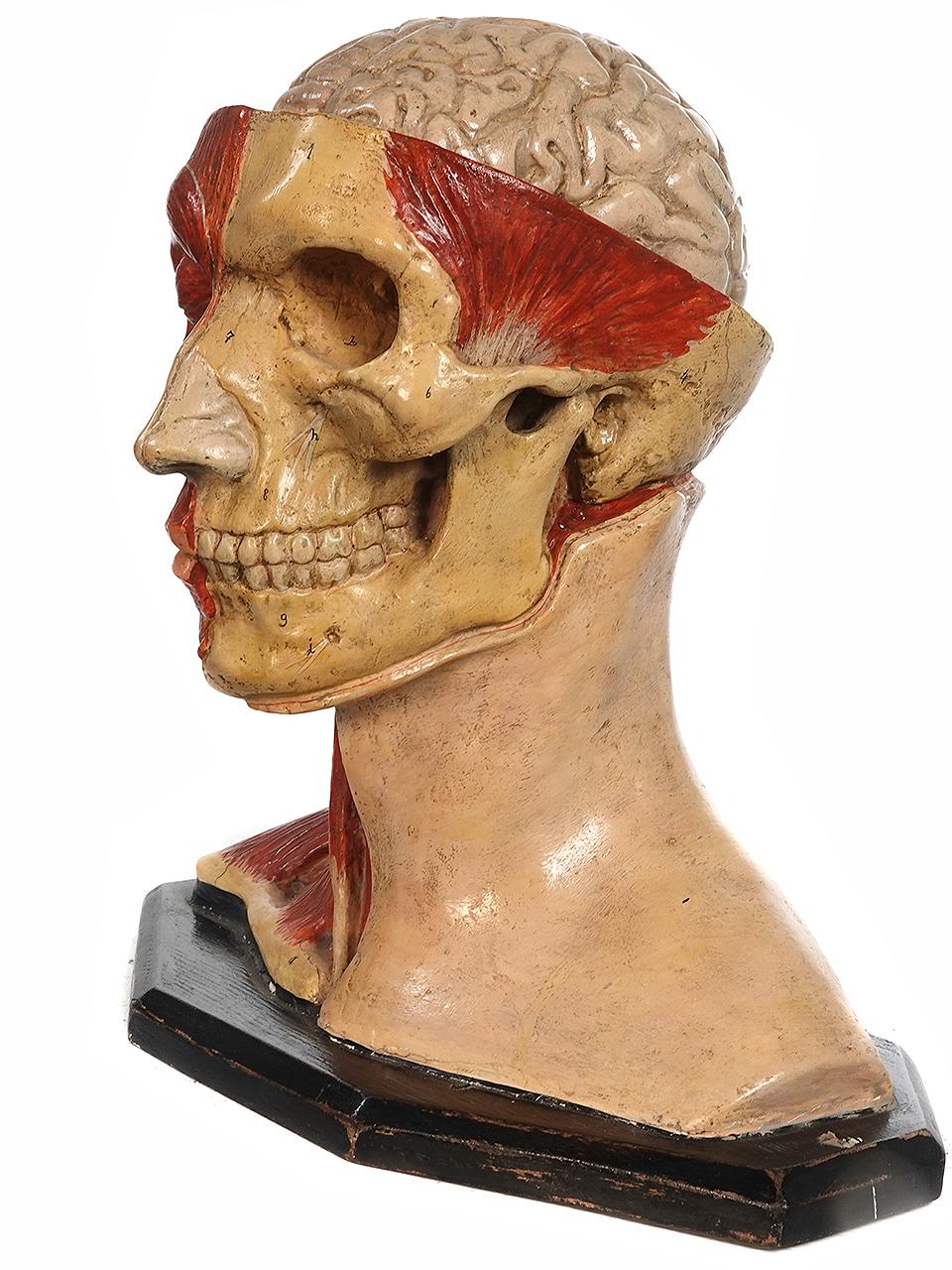 This is an early and high quality hand-painted plaster antique anatomical model of an adult human head. I would date this to 1900. The details are well-done and the brain is removable and splits in two. There is some plaster missing on the bottom of