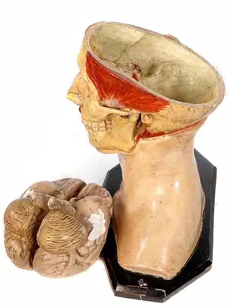 This is an early and high quality hand-painted plaster antique anatomical model of an adult human head. I would date this to 1900. The details are well-done and the brain is removable and splits in two. There is some plaster missing on the bottom of