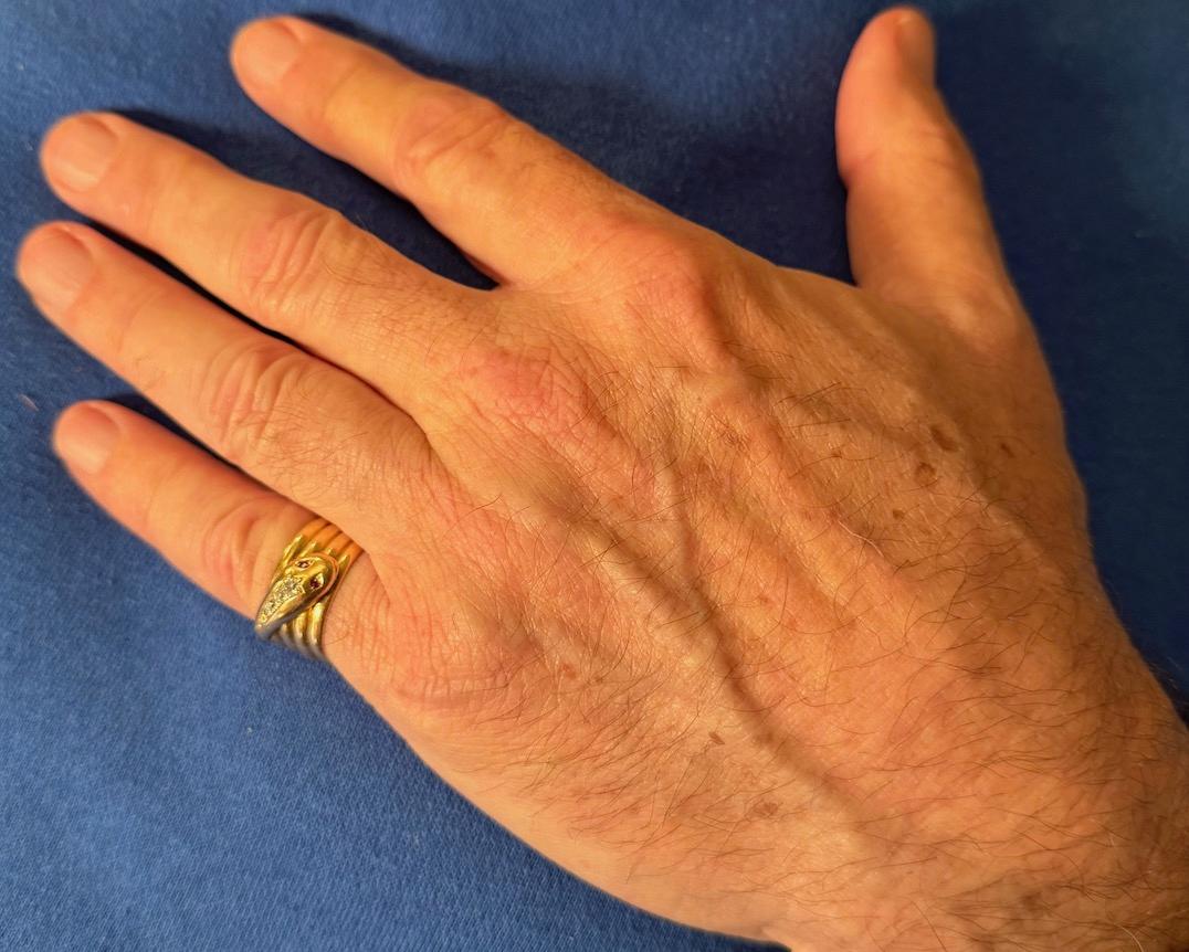 Anello a serpente in oro 18 carati con marchio Birmingham 1903 in vendita 9