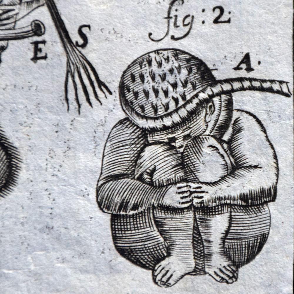 18th Century Human Body Medical Lithograph Prints 3