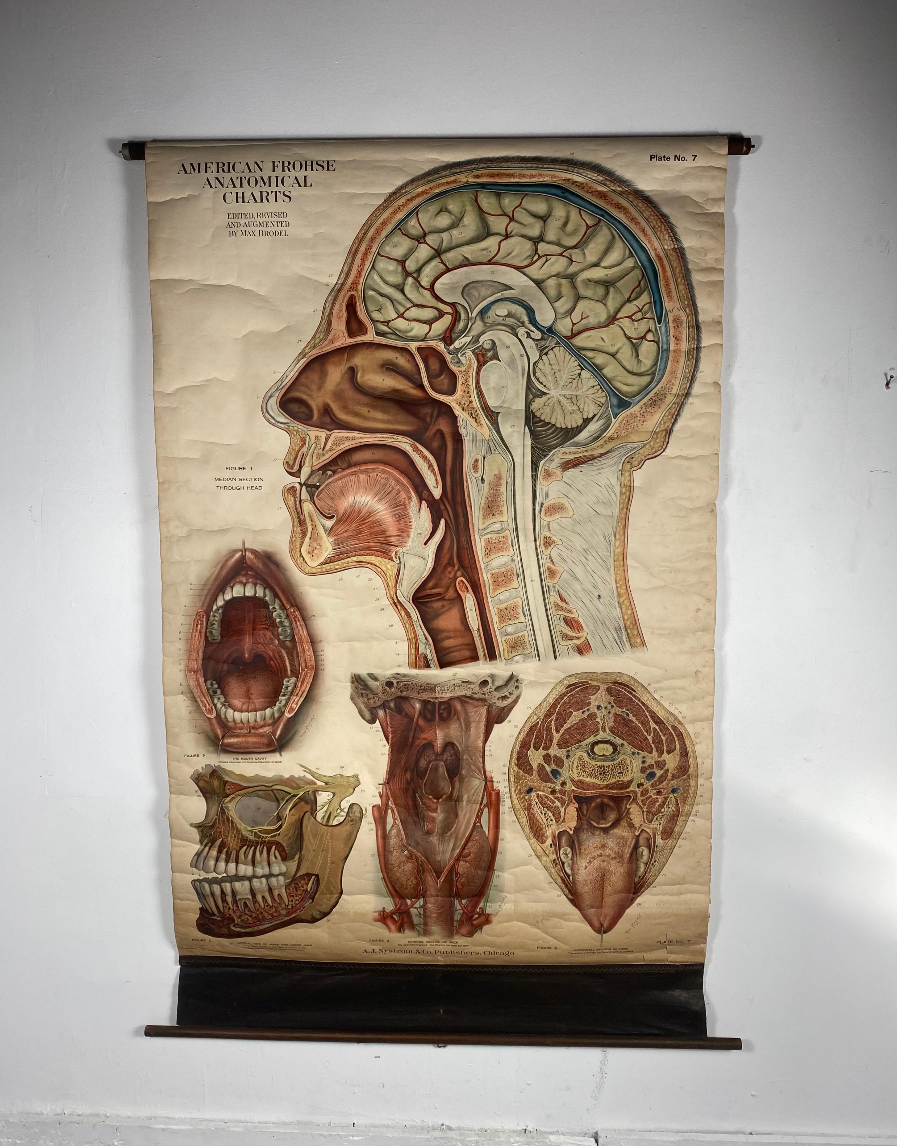 Antique American Frohse Anatomical pull down chart, by A. J. Nystrom, ,revised and augmented by Max Brodel illustrator... Amazing color, patina, age appropriate wear. dated 1918..
Max (Paul Heinrich) Brödel
1870-1941
Brödel, an illustrator and