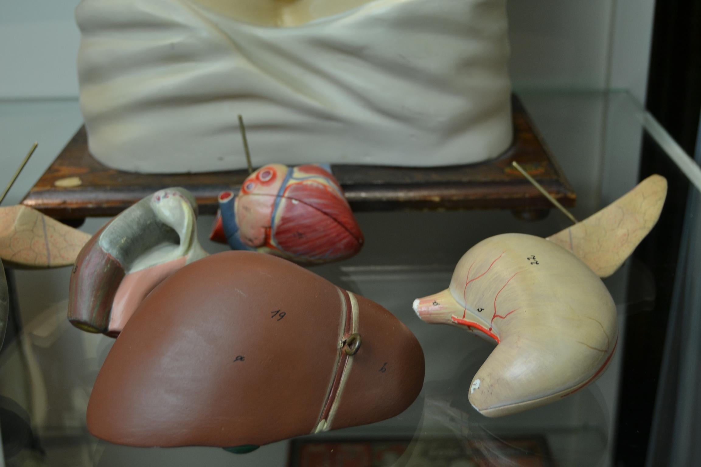 1930s Plaster Anatomical Torso , Didactic or  Educational  Model , Germany 1