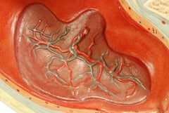 Modello didattico degli anni '30 raffigurante la pancia della donna subito dopo il parto