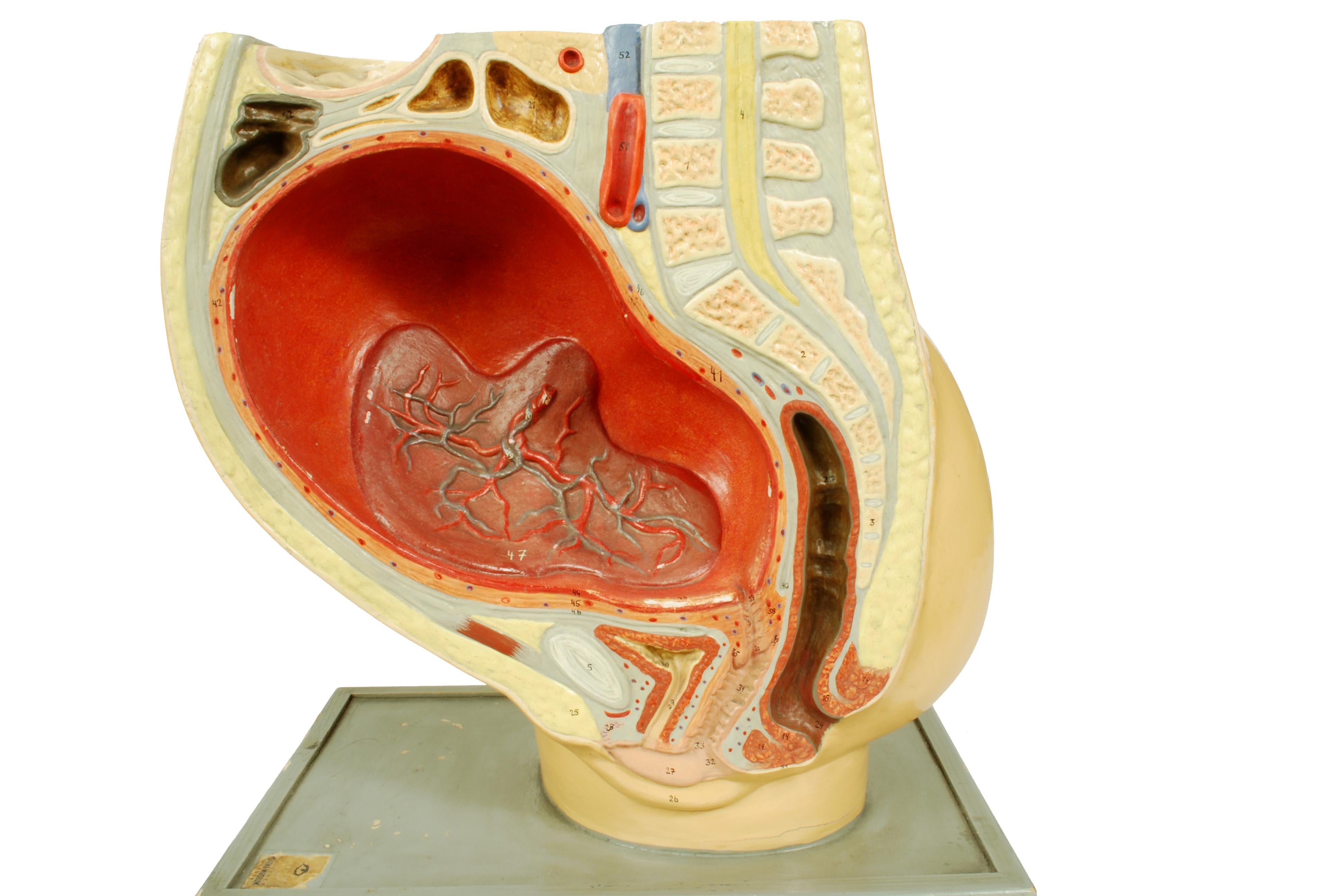 1930s Educational Model Depicting the Belly of the Woman Immediately After Birth For Sale 4