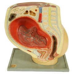 1930s Educational Model Depicting the Belly of the Woman Immediately After Birth