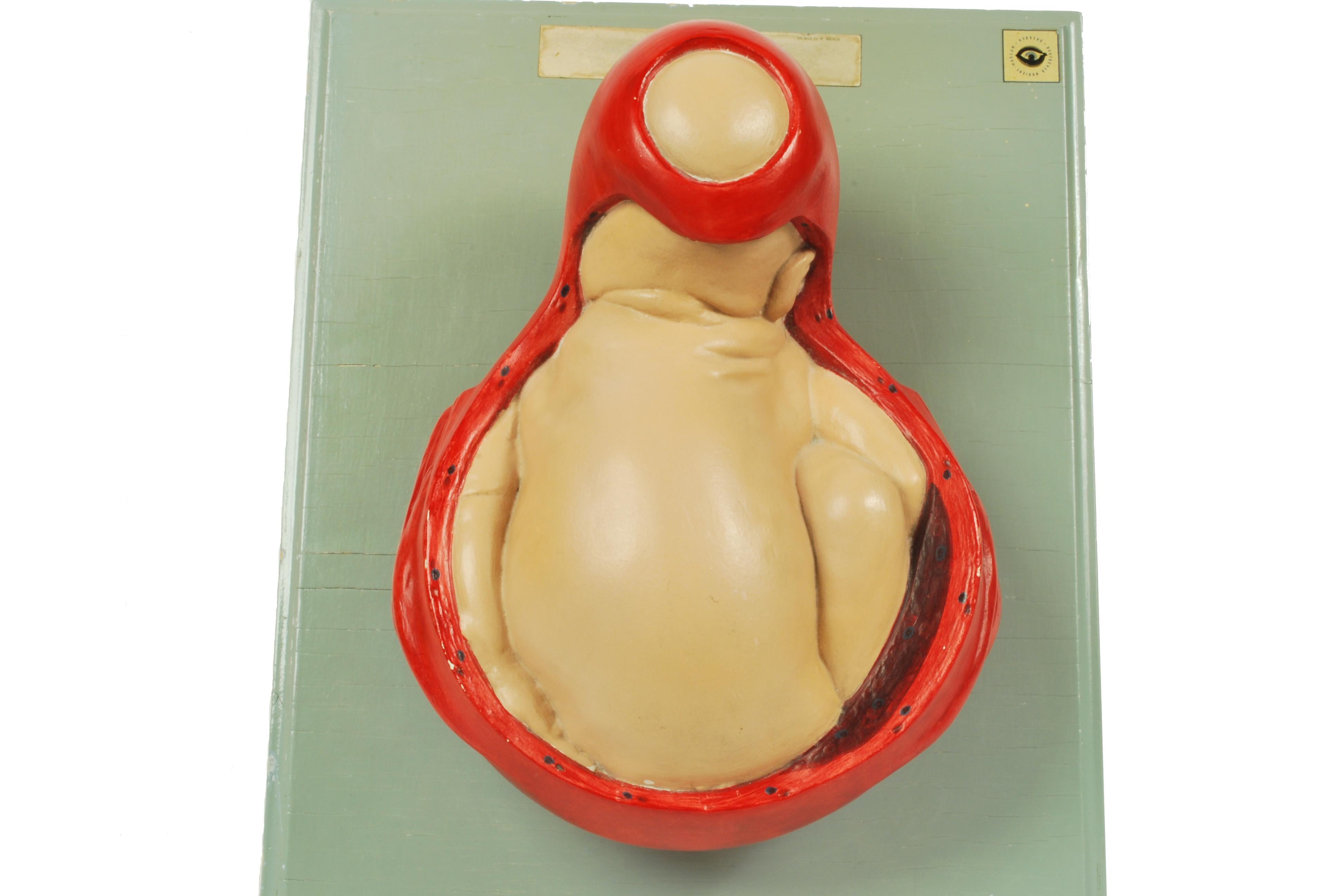 Educational model, papier maché and plaster, decipting a baby borning. 1930s-1940s, sold by the Hygiene Museum in Dresden. Very good condition. Measures of the board cm 45x35 - inches 17.72x13.77.

The creation of the Deutsches Hygiene-Museum