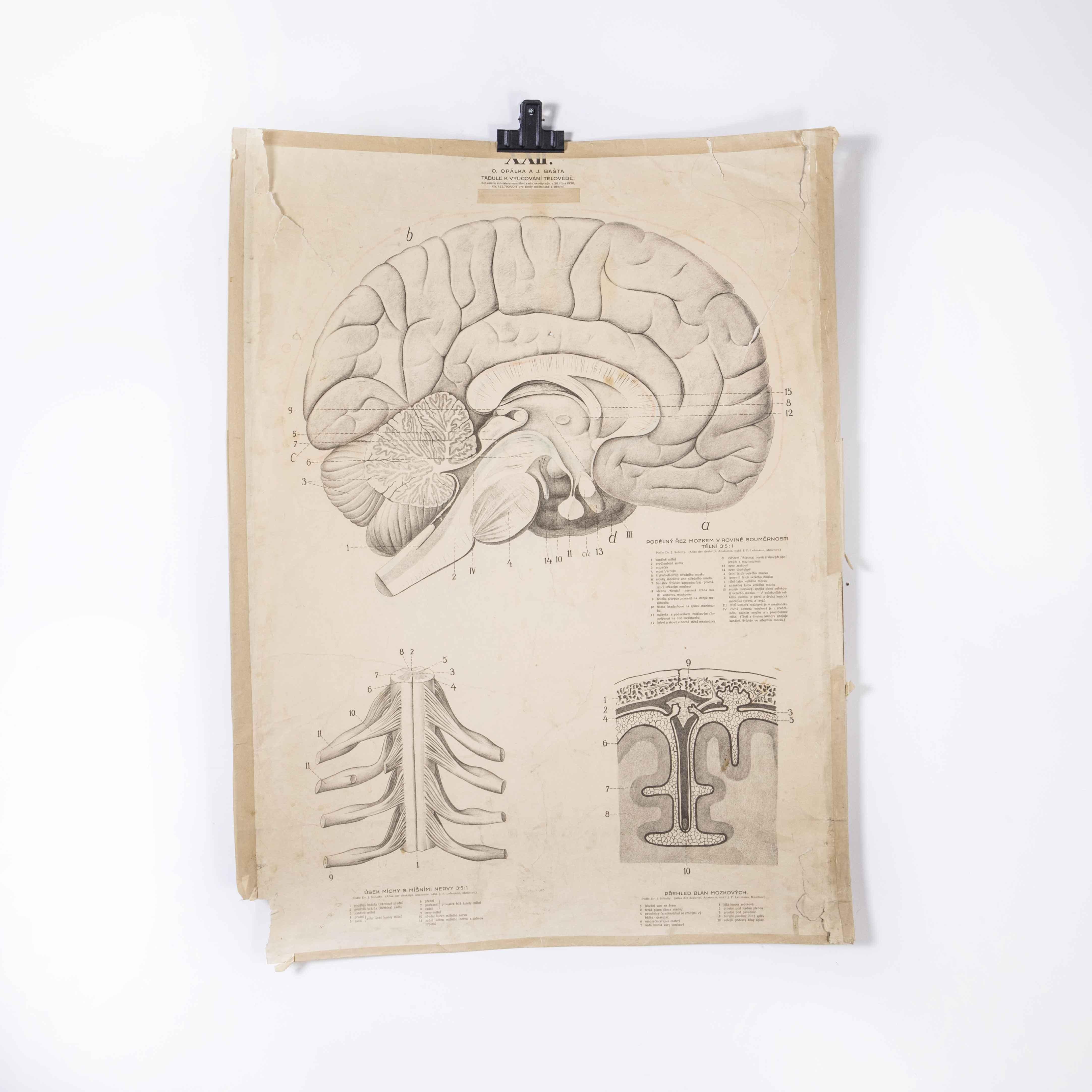 Czech 1930's Educational Poster - Human Anatomy Brain For Sale