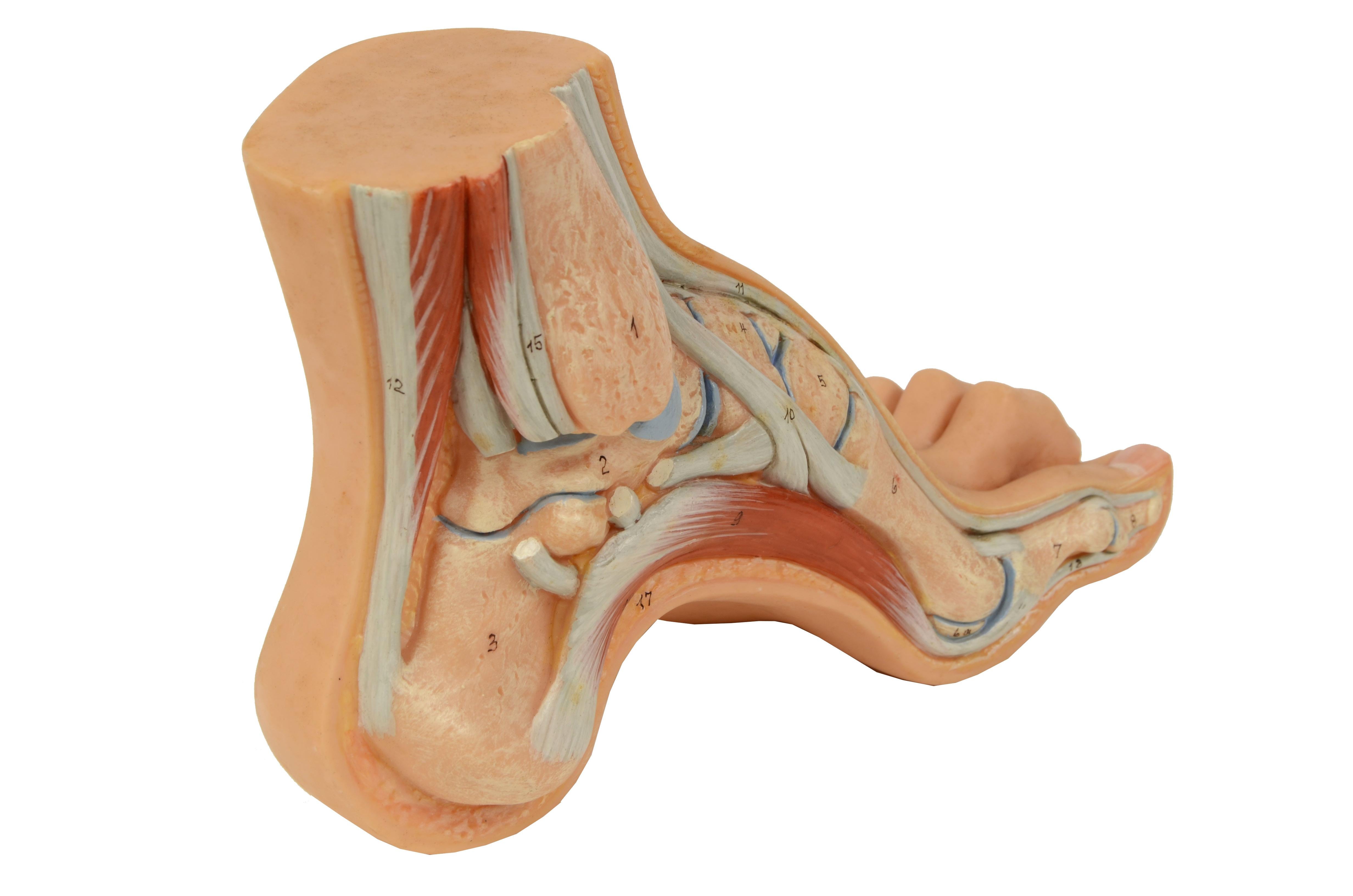 Anatomisches Lehrmodell in normaler Größe, das einen Hohlfuß im Schnitt zeigt, bei dem das Fußgewölbe stark ausgeprägt ist und die Fußauflage hauptsächlich auf dem Vorfuß und der Ferse liegt. 
Der geschnittene Teil zeigt die verschiedenen Teile des
