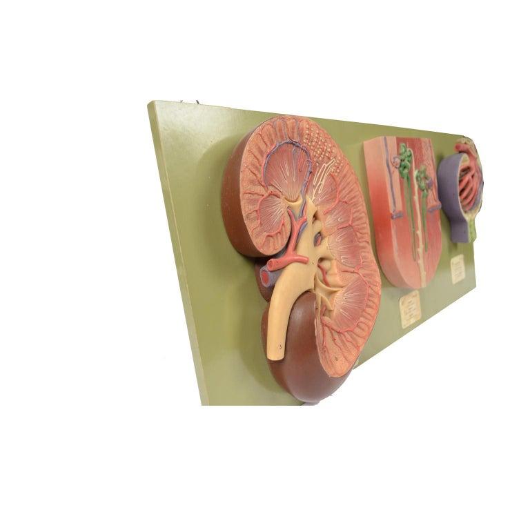 Large anatomical teaching model consisting of: right kidney enlarged 3 times; nephron enlarged about 120 times; corpuscle of Malpighi enlarged 700 times. Made of hand-colored resin in the 1950s by Somso, a German company active since the second half