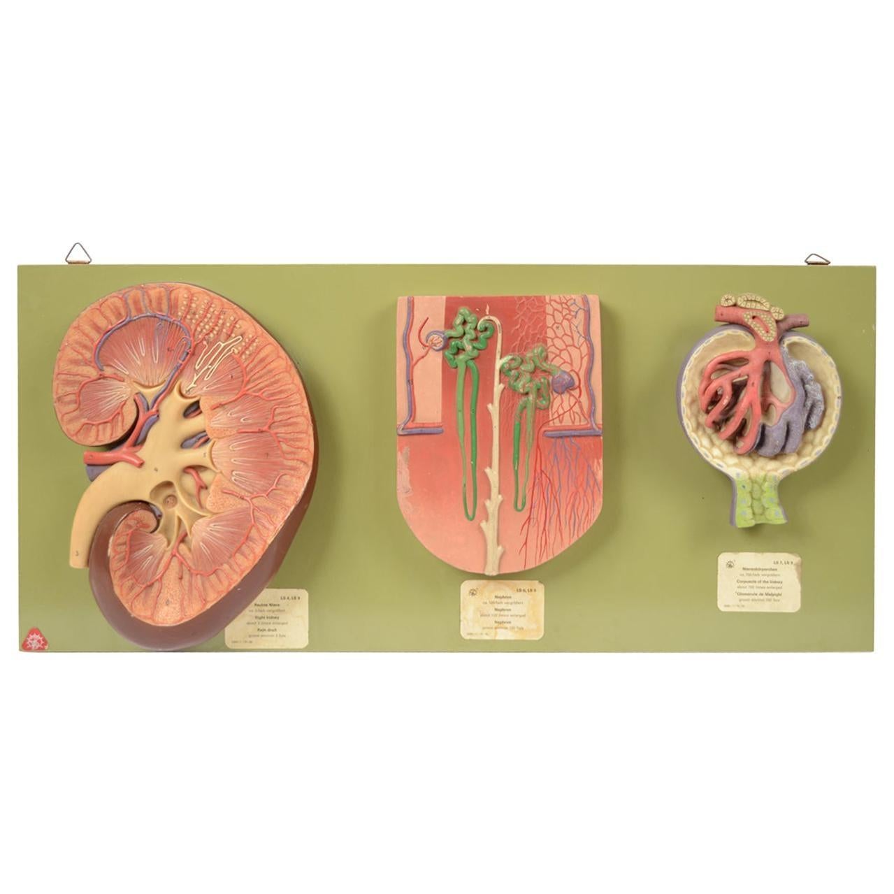 1950s Vintage Somso Anatomical Medical Didactic Model of kidney