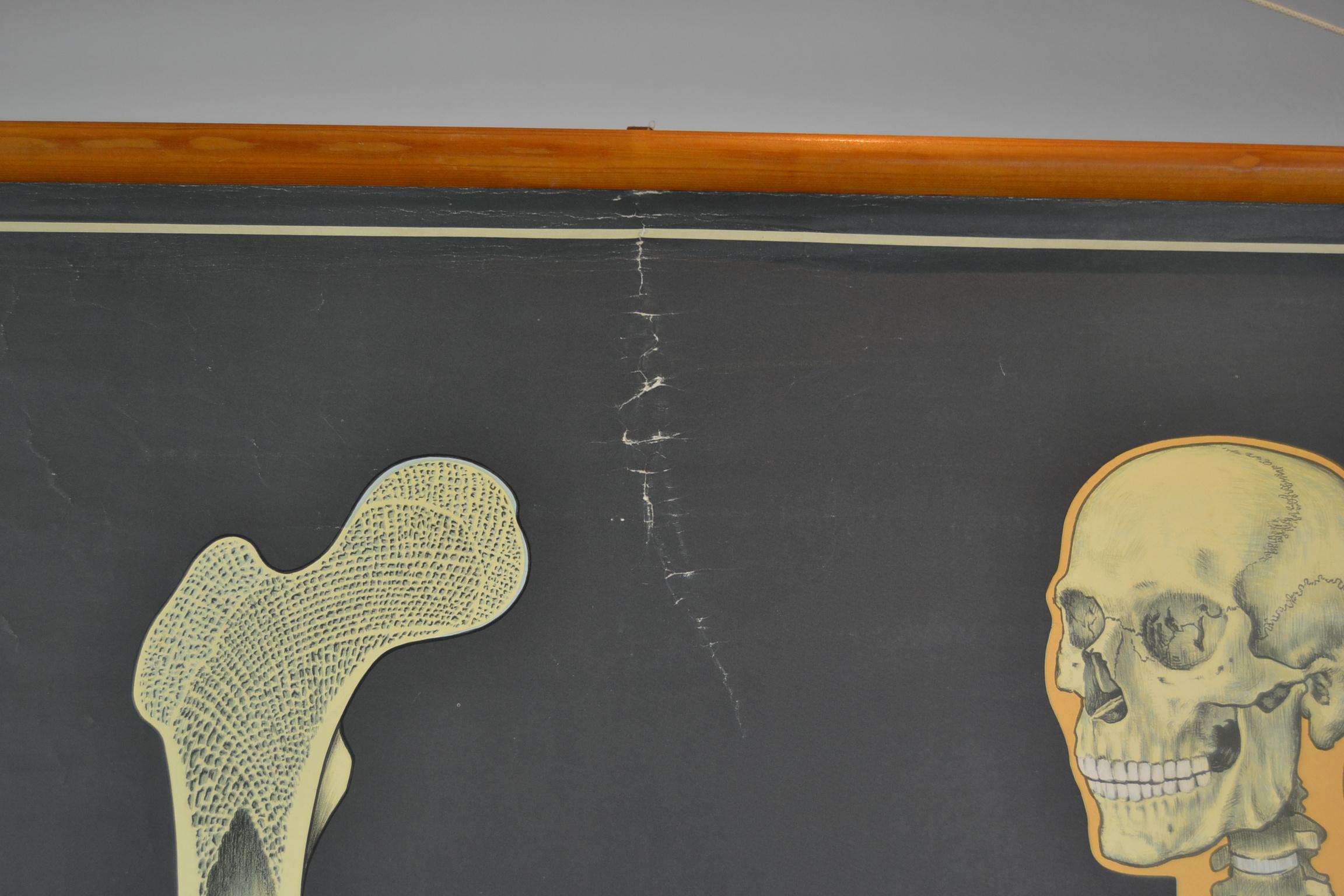 1960s Anatomical Chart Human Skeleton by Wilhelm Hagemann, Germany 1