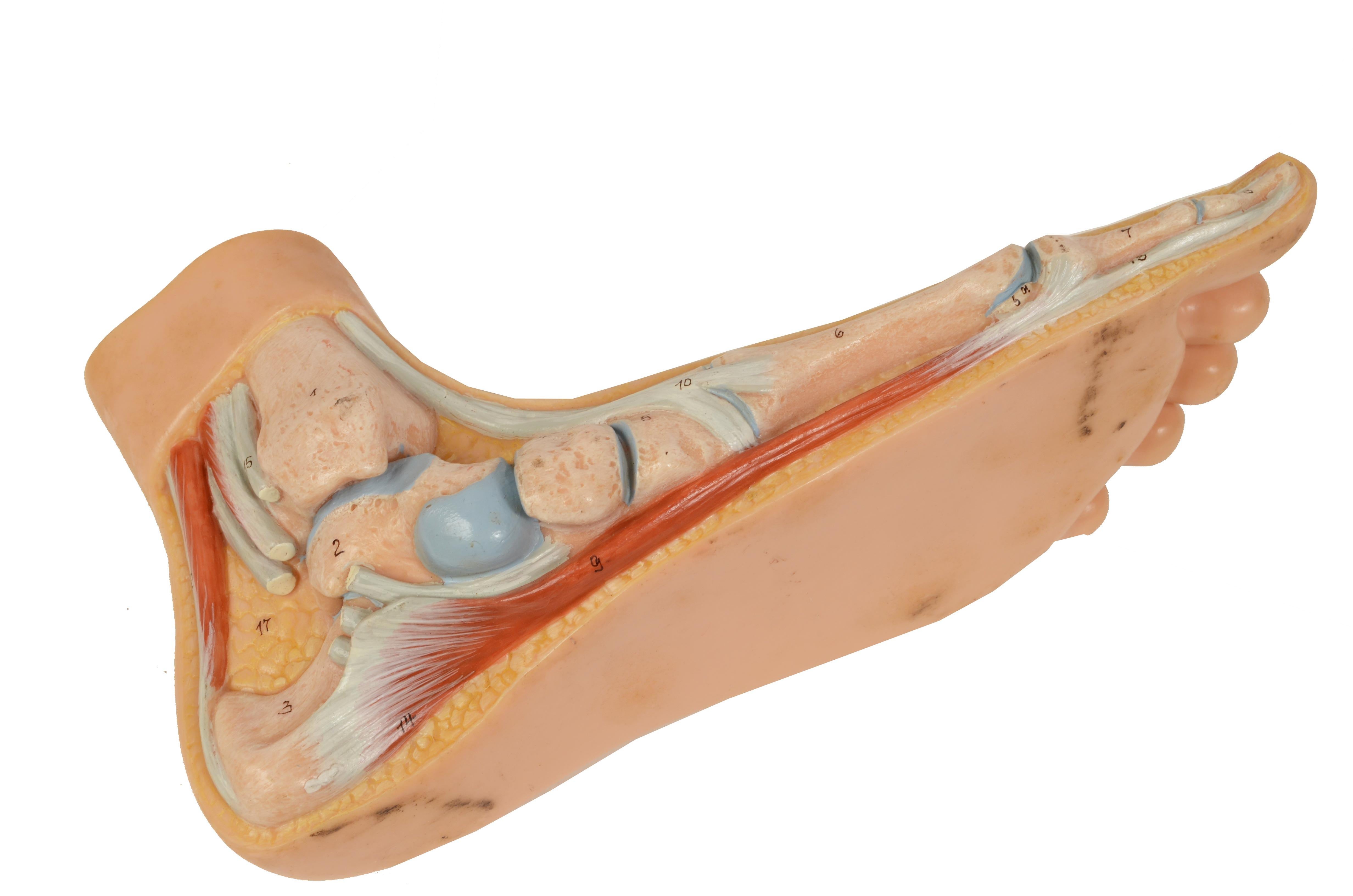 Anatomisches Lehrmodell in normaler Größe aus den 1950er Jahren mit flachem Fuß, „Pes Planus“ im Angebot 5