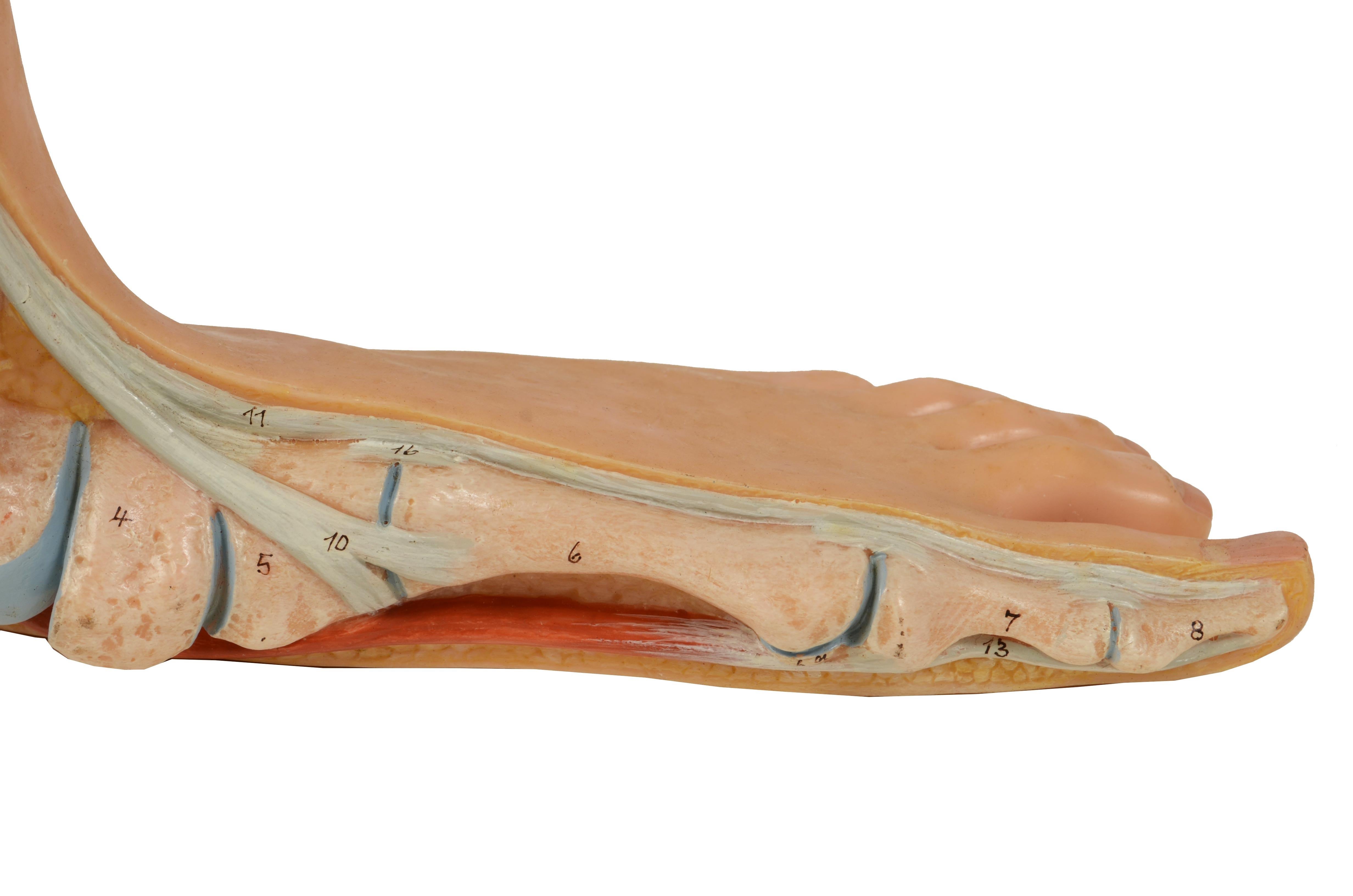 Anatomisches Lehrmodell in normaler Größe aus den 1950er Jahren mit flachem Fuß, „Pes Planus“ (Kunststoff) im Angebot