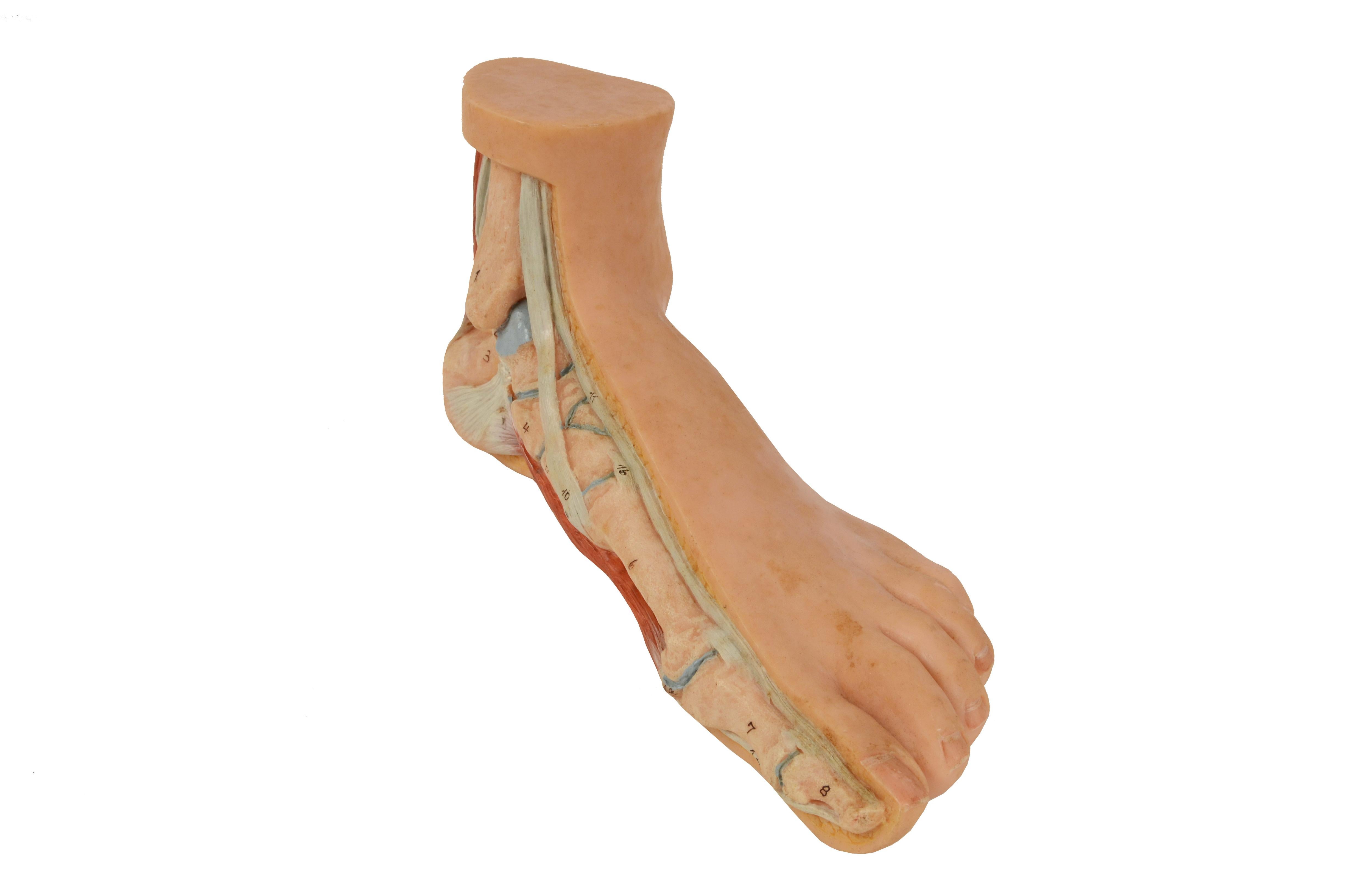 Anatomisches Lehrmodell in normaler Größe aus den 1950er Jahren mit flachem Fuß, „Pes Planus“ im Angebot 1