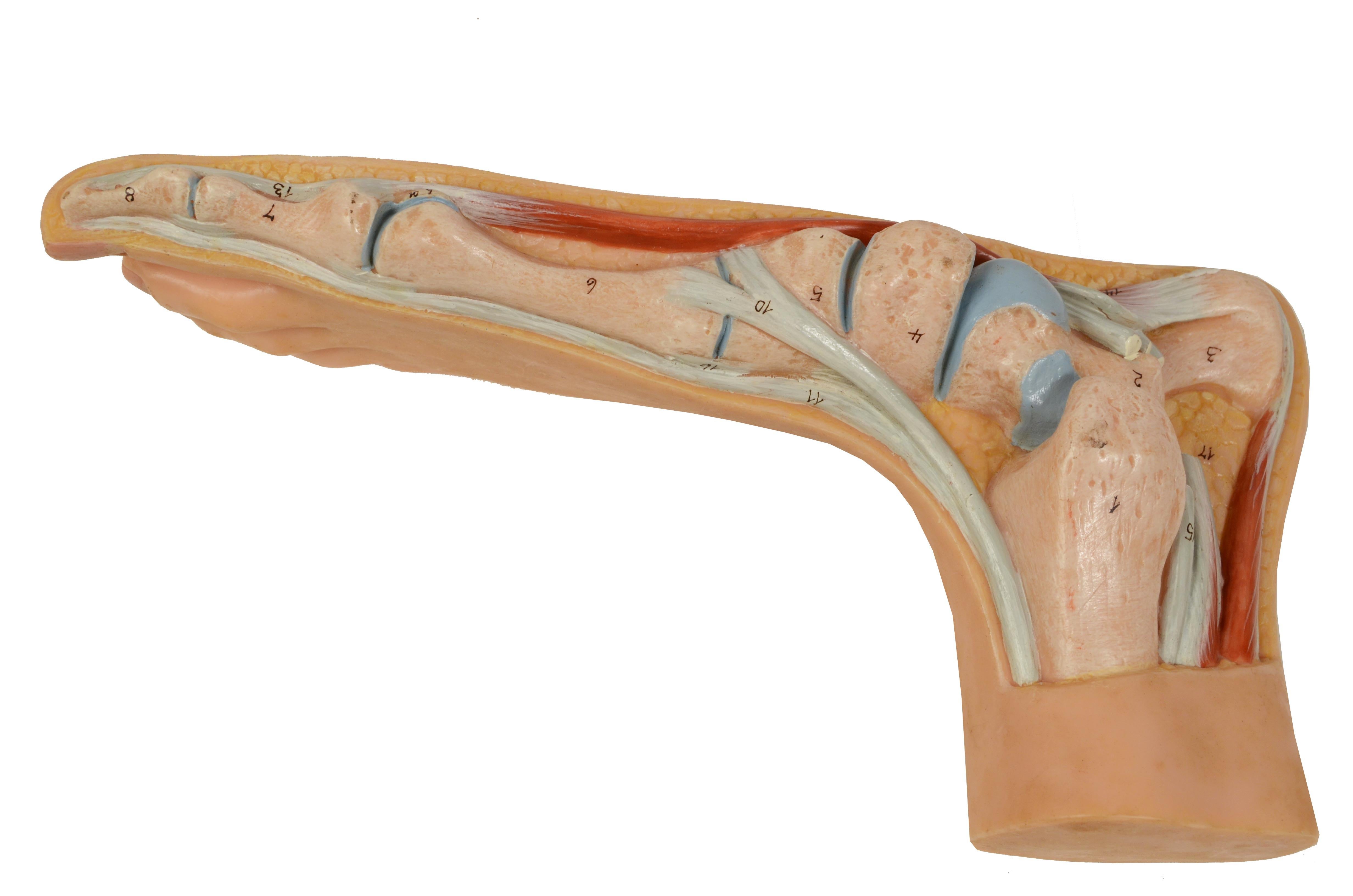Anatomisches Lehrmodell in normaler Größe aus den 1950er Jahren mit flachem Fuß, „Pes Planus“ im Angebot 4