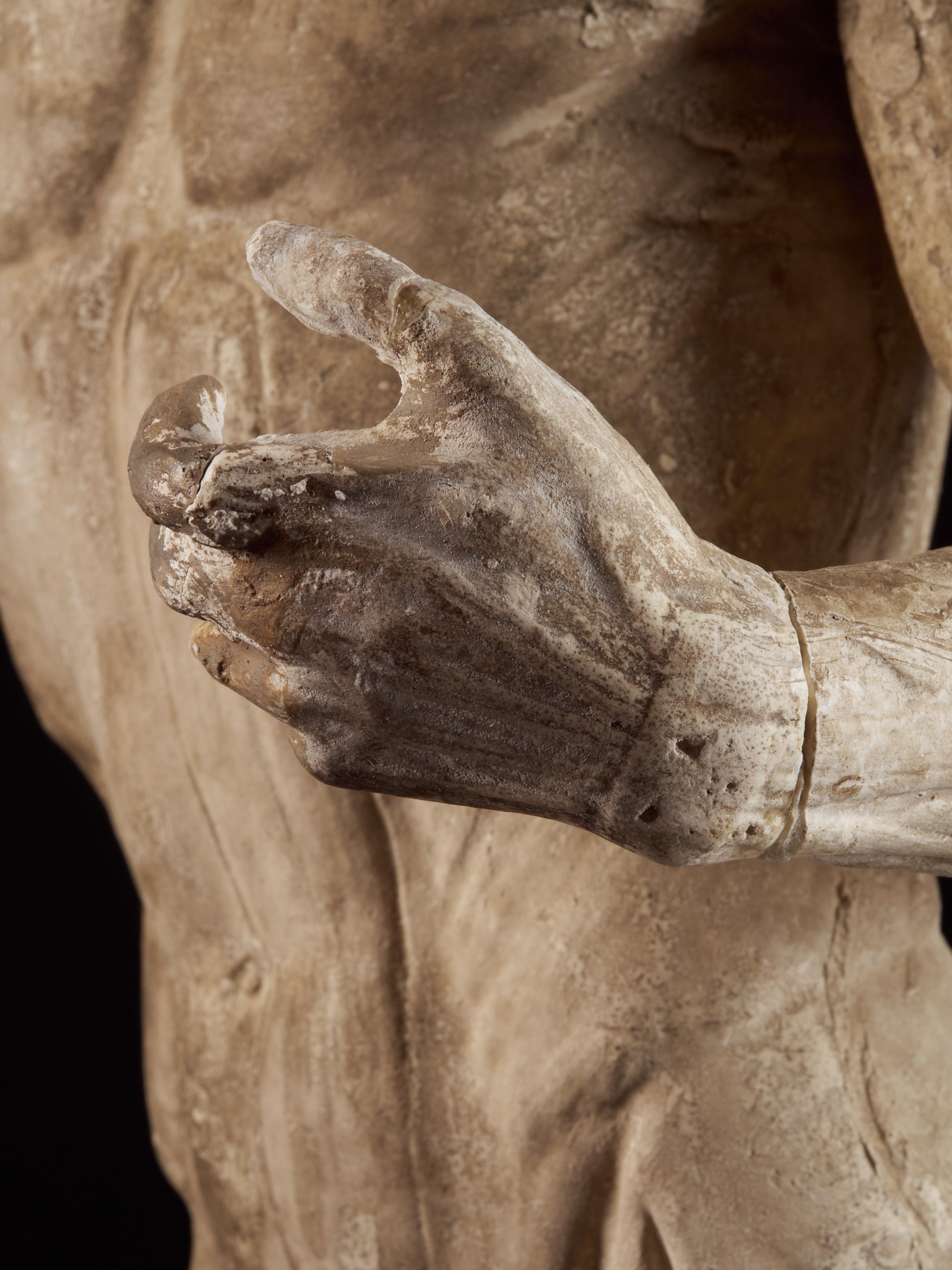 19th Century, Italian School, Two Anatomical Flayed Figures in Plaster 10