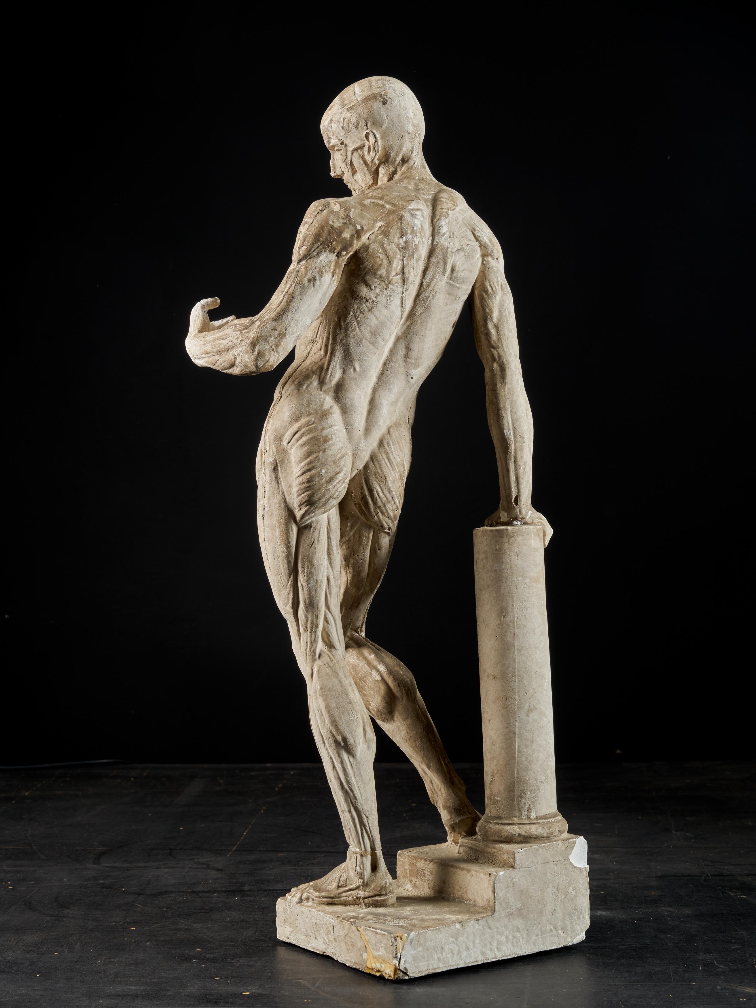 19th Century, Italian School, Two Anatomical Flayed Figures in Plaster In Fair Condition In Leuven , BE