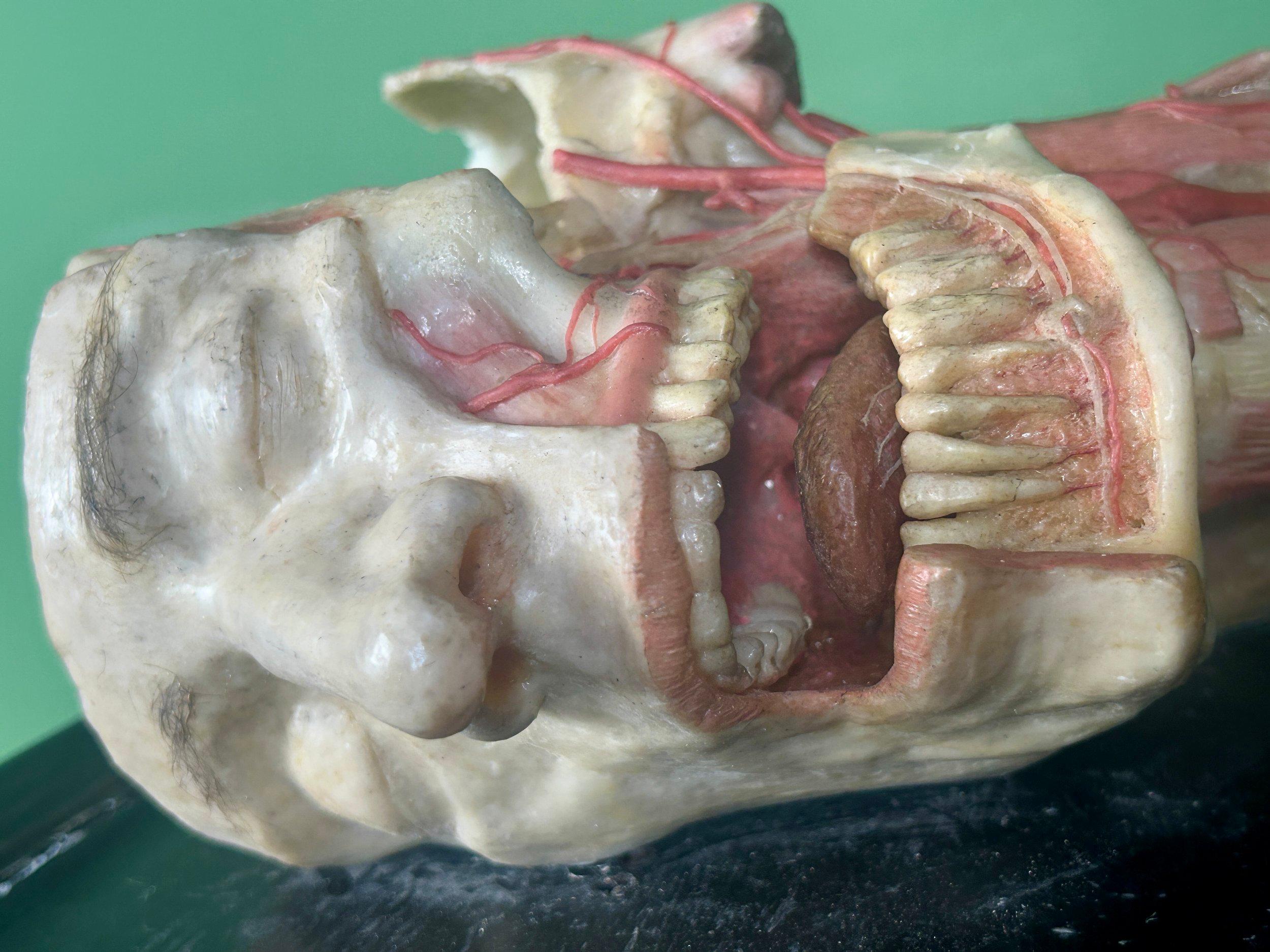19th Century Anatomical Model of Dissected Wax Head Mounted on Framed Board en vente 2