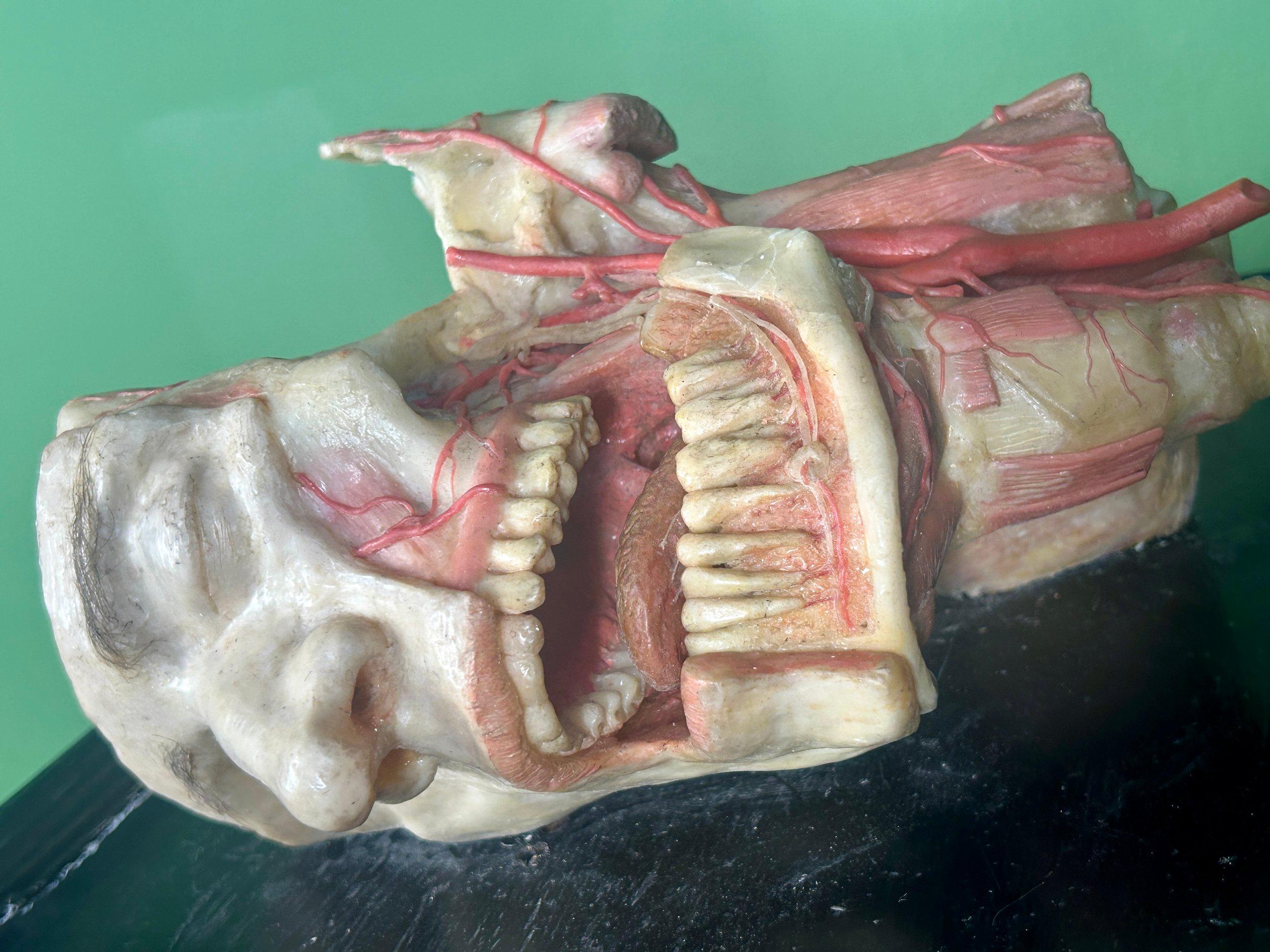 19th Century Anatomical Model of Dissected Wax Head Mounted on Framed Board en vente 4