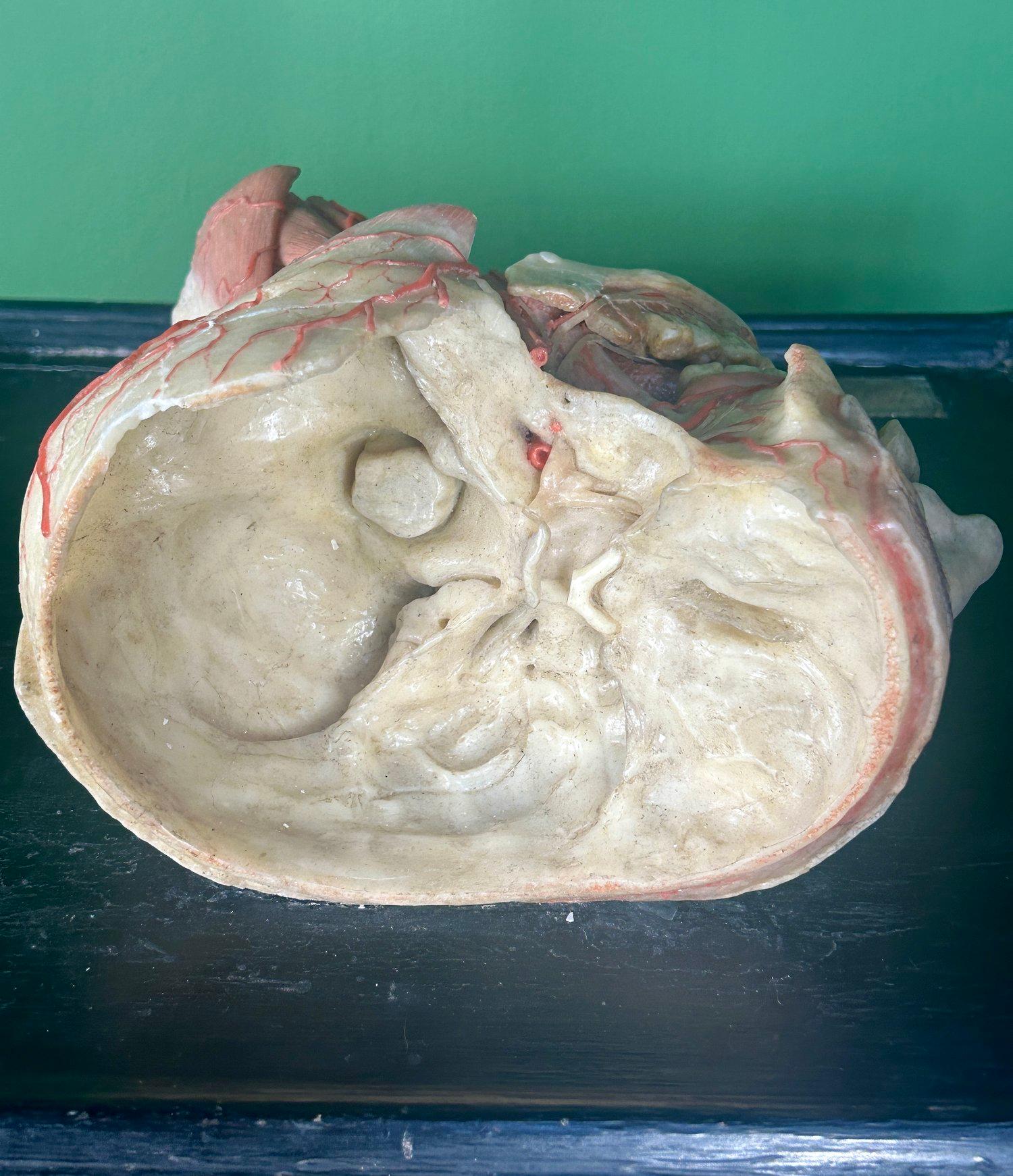 19th Century Anatomical Model of Dissected Wax Head Mounted on Framed Board en vente 5