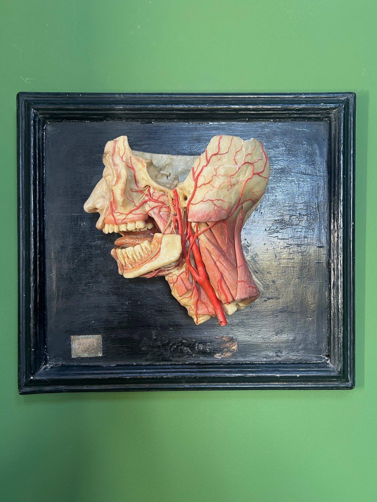 Modèle anatomique antique, modèle anatomique en cire, tête antique en cire, antiquité médicale, antiquité anatomique, modèle anatomique vintage, cabinet de curiosités antique, antiquité gothique, sculpture anatomique.

Rare modèle anatomique de
