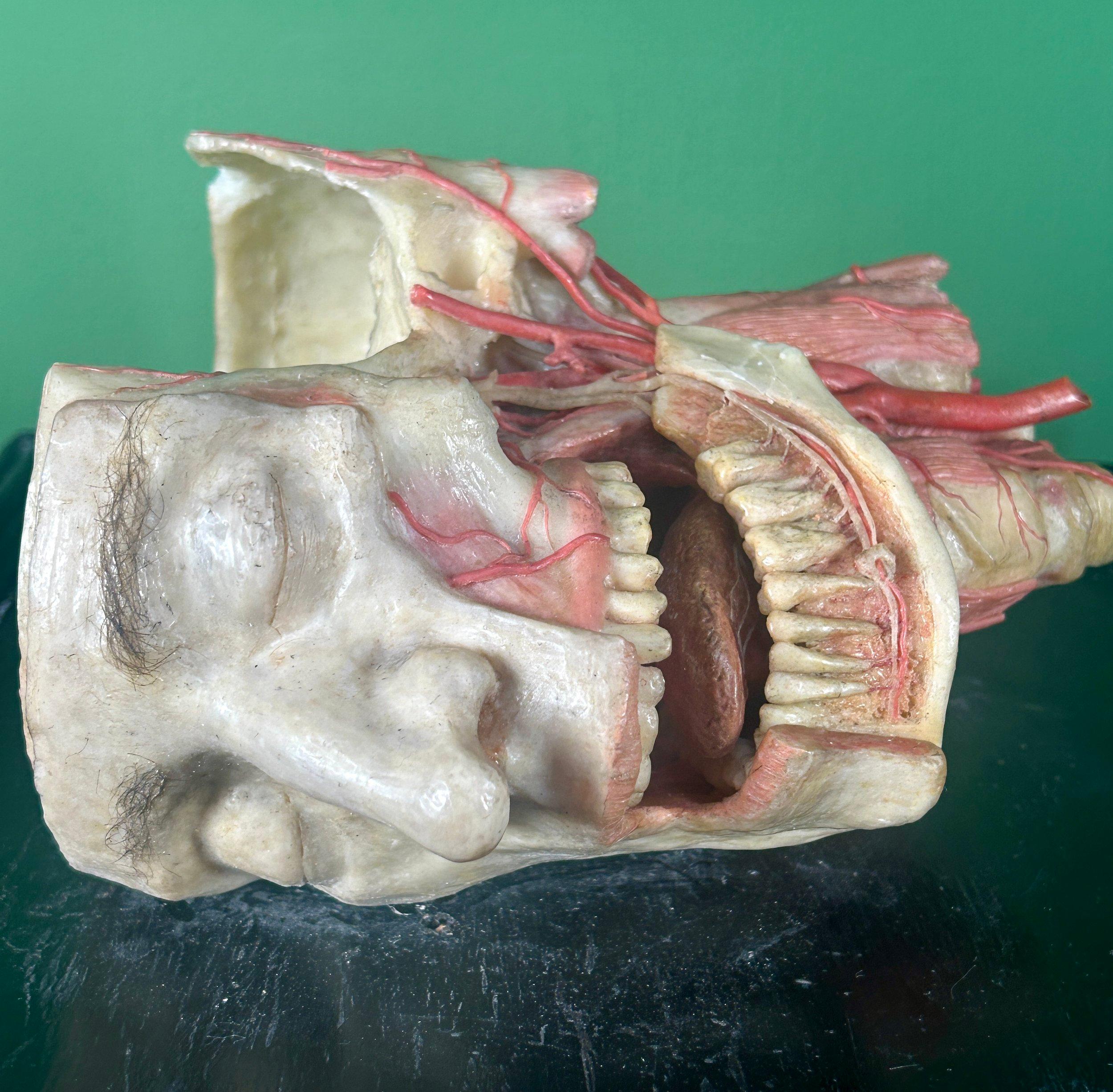 Gothique 19th Century Anatomical Model of Dissected Wax Head Mounted on Framed Board en vente