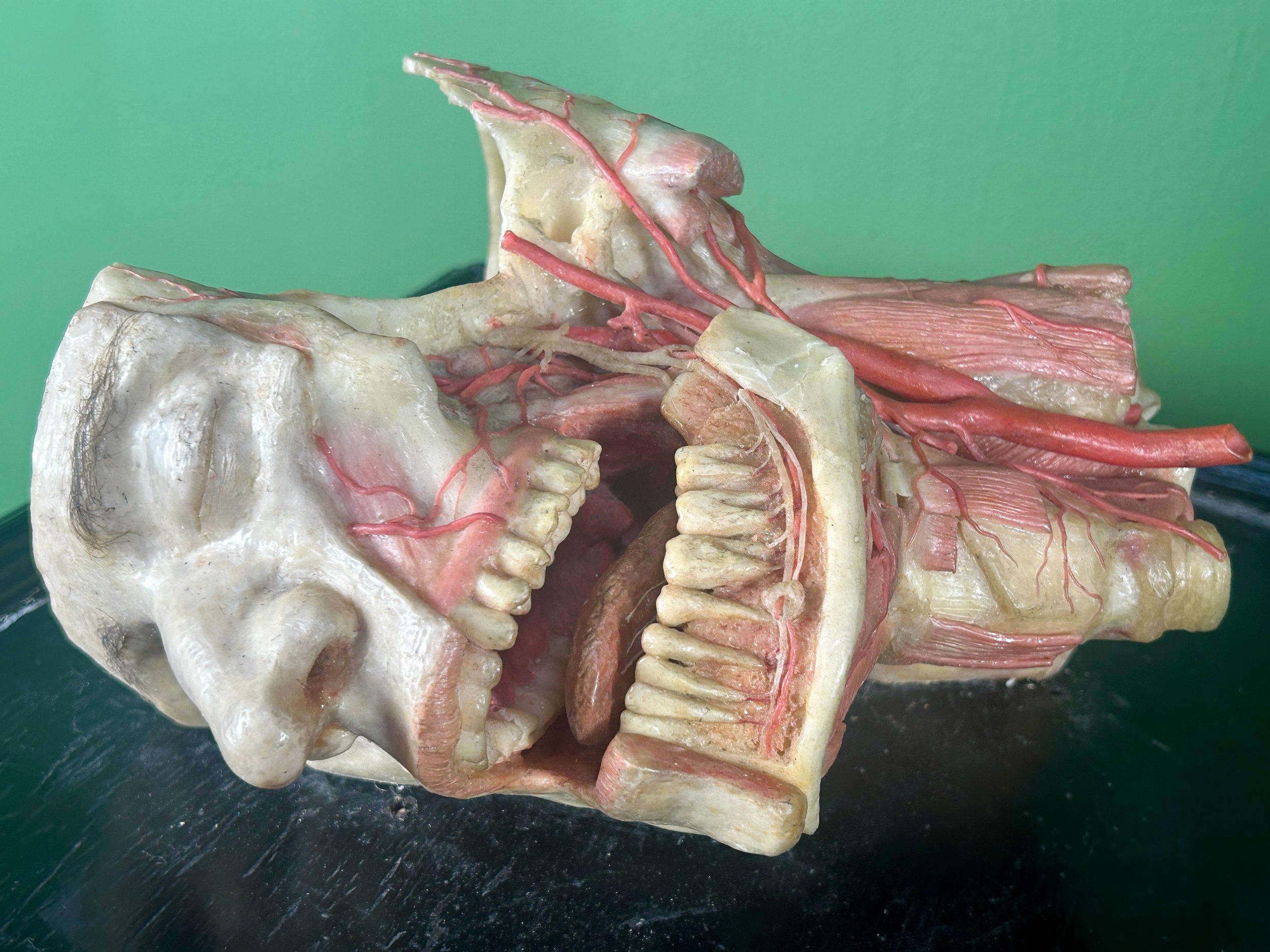 Allemand 19th Century Anatomical Model of Dissected Wax Head Mounted on Framed Board en vente