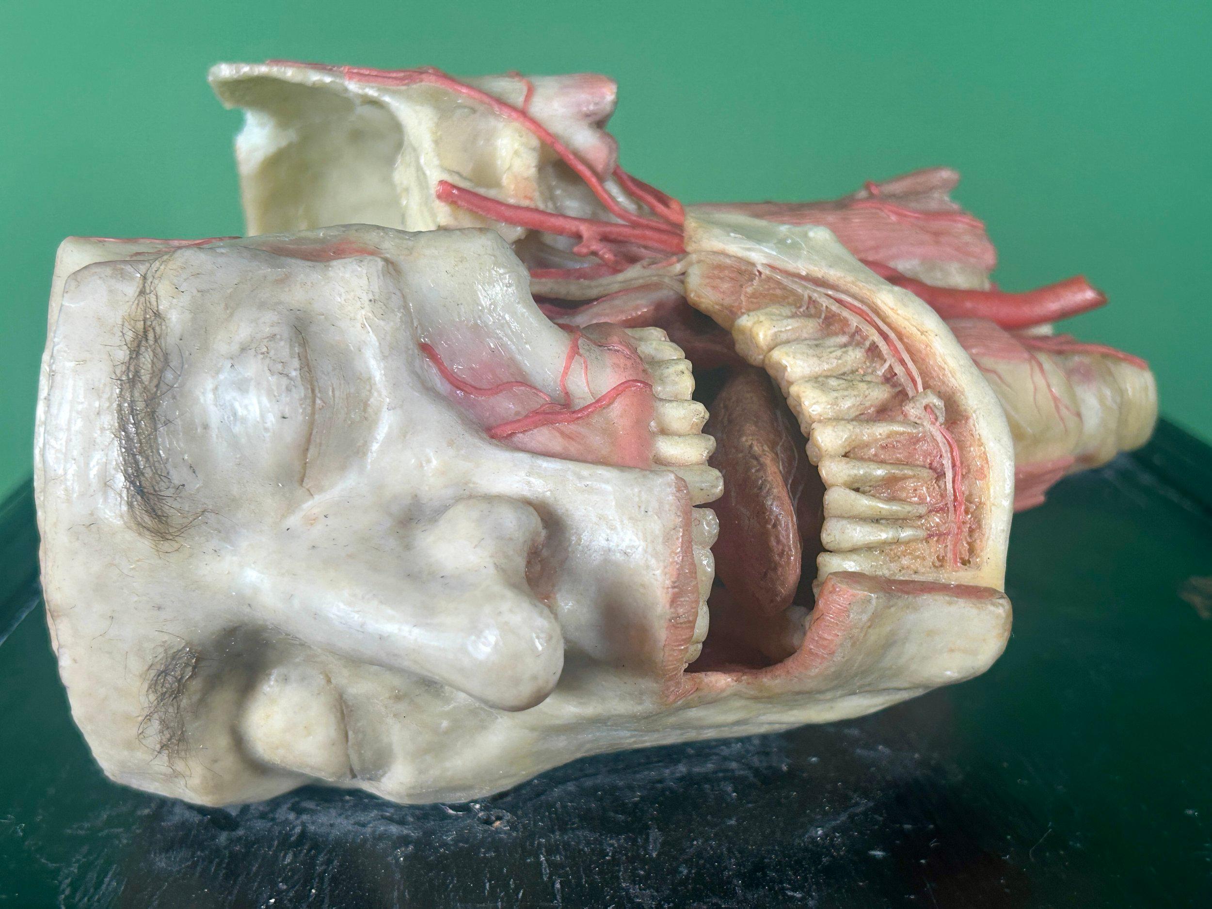 Sculpté 19th Century Anatomical Model of Dissected Wax Head Mounted on Framed Board en vente