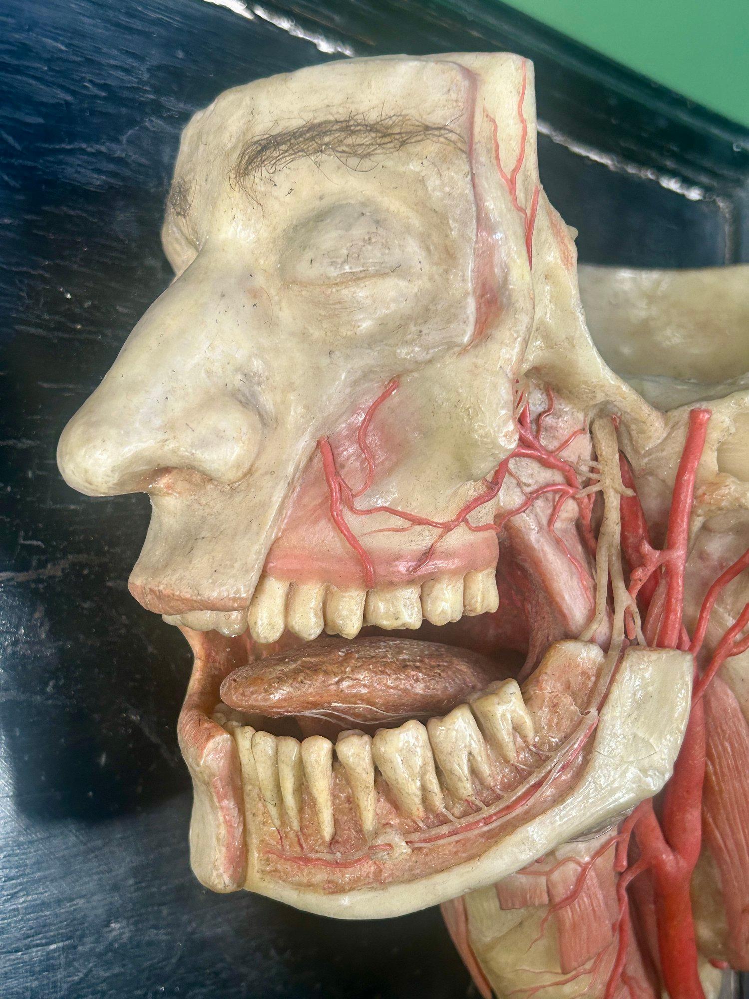 XIXe siècle 19th Century Anatomical Model of Dissected Wax Head Mounted on Framed Board en vente
