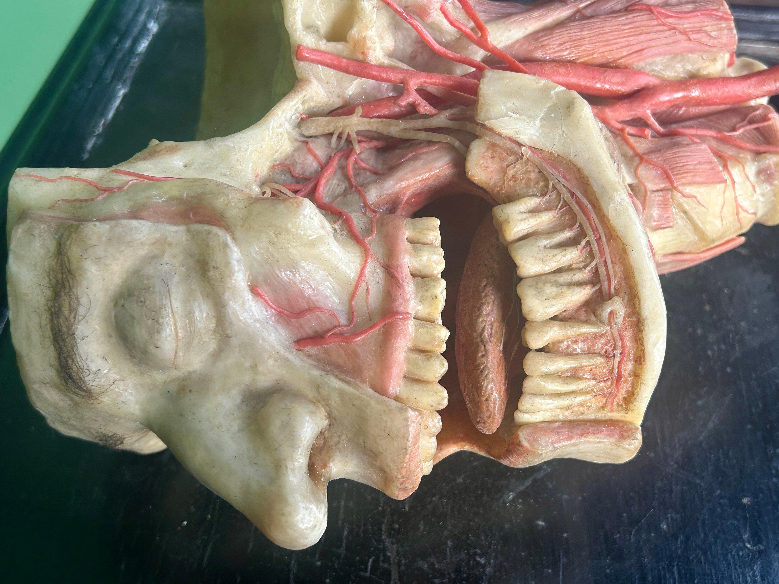 19th Century Anatomical Model of Dissected Wax Head Mounted on Framed Board en vente 1