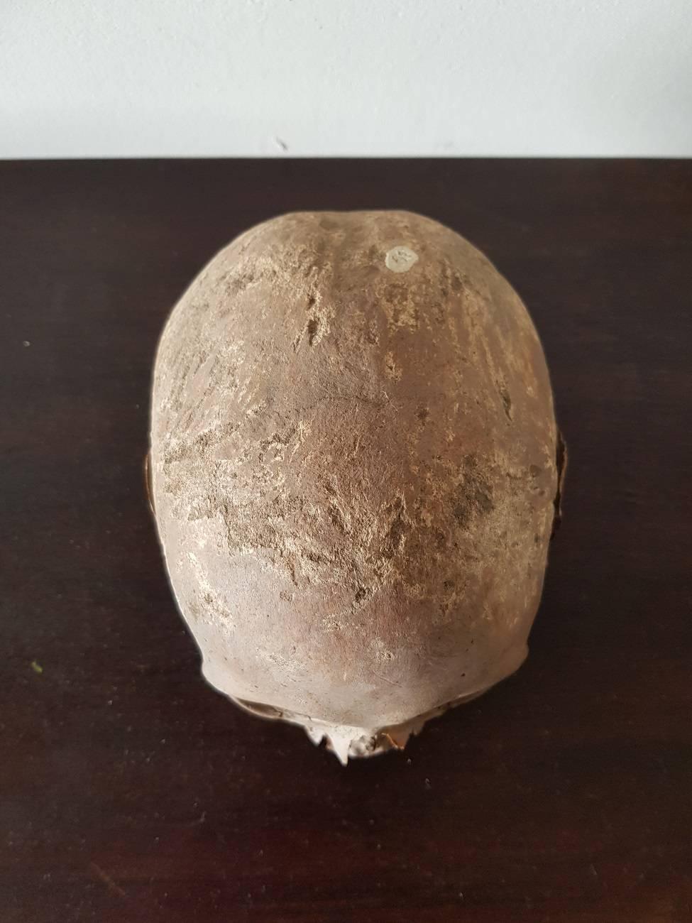 19th Century Antique Human Skull In Excellent Condition In Raalte, NL