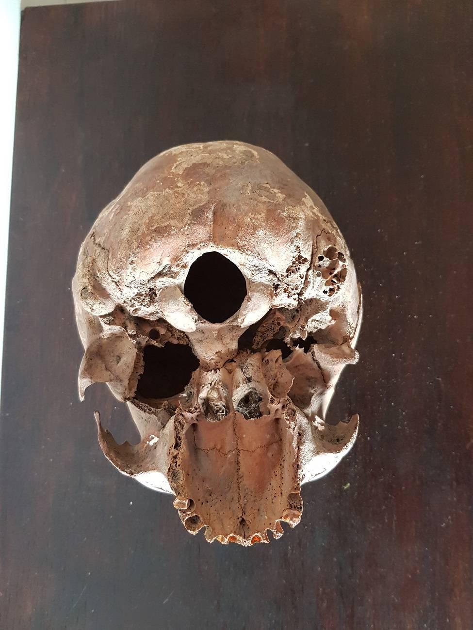 Bone 19th Century Antique Human Skull
