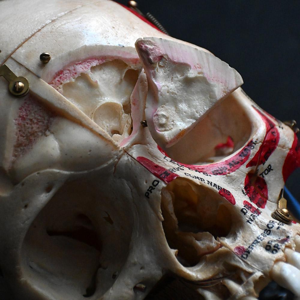 Crâne humain médical articulé du 19e siècle en vente 4