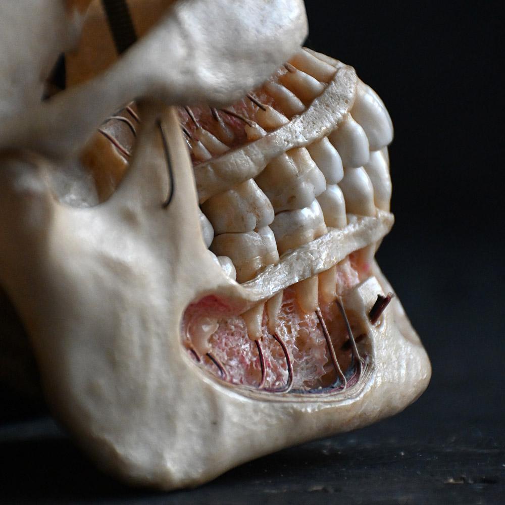 Début du 20ème siècle Crâne humain médical articulé du 19e siècle en vente