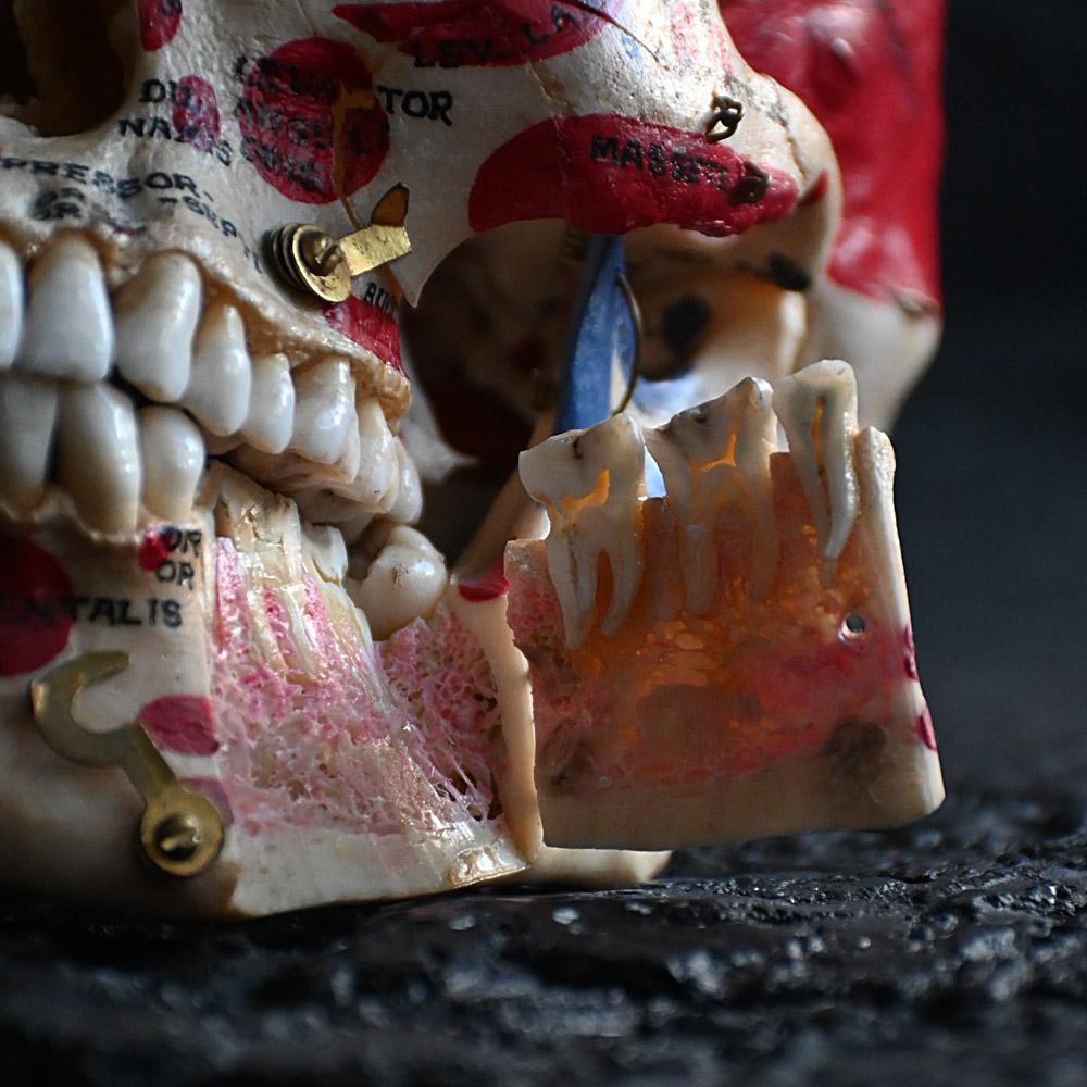 Crâne humain médical articulé du 19e siècle en vente 2