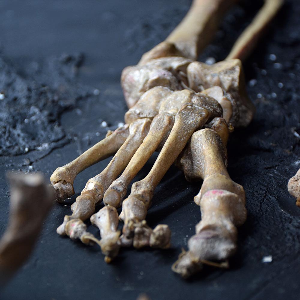 19th Century Half Human Medical Skelton 3