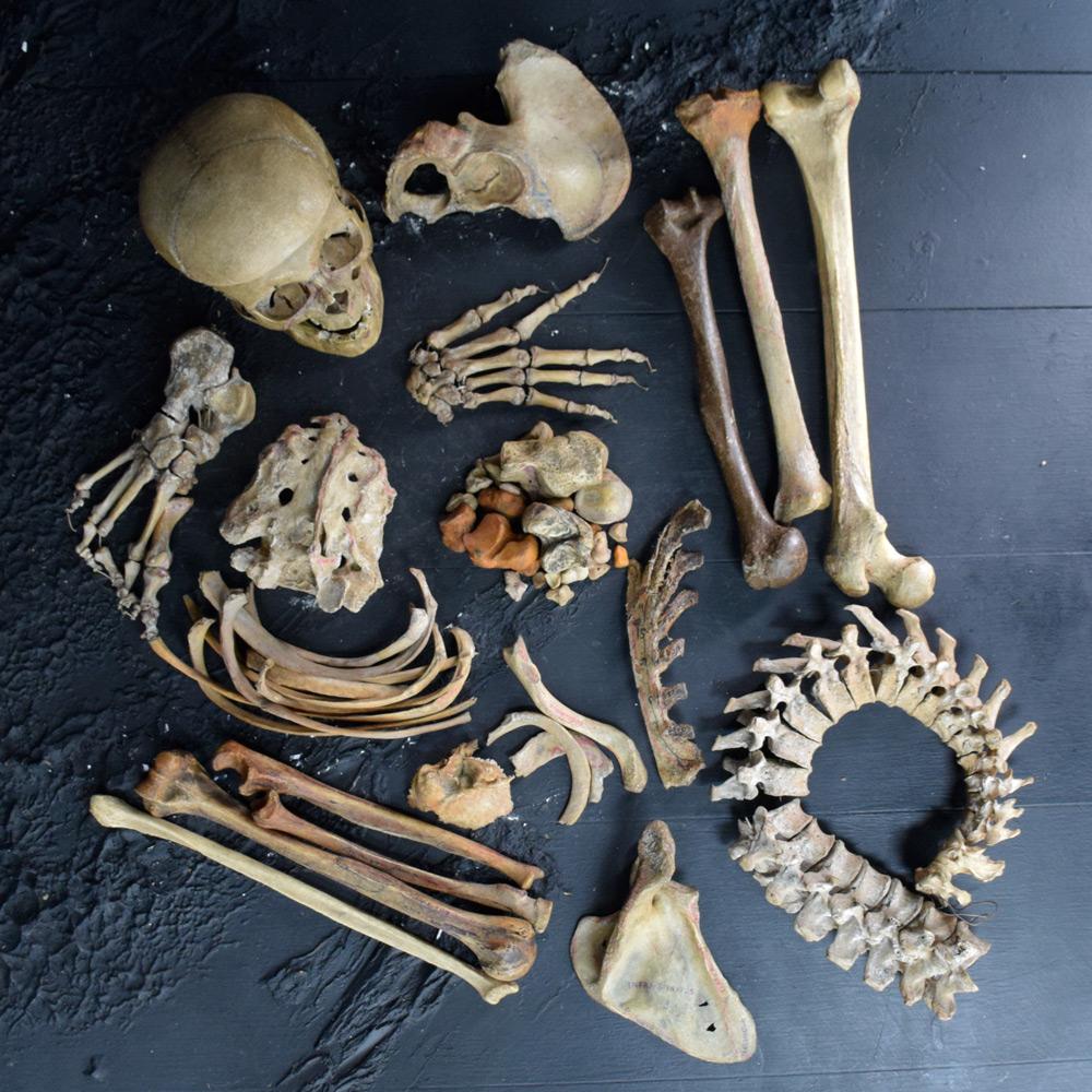 Natural Fiber 19th Century Half Human Medical Skelton