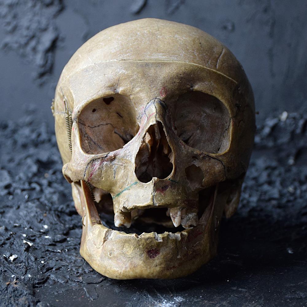 19th Century Half Human Medical Skelton 1