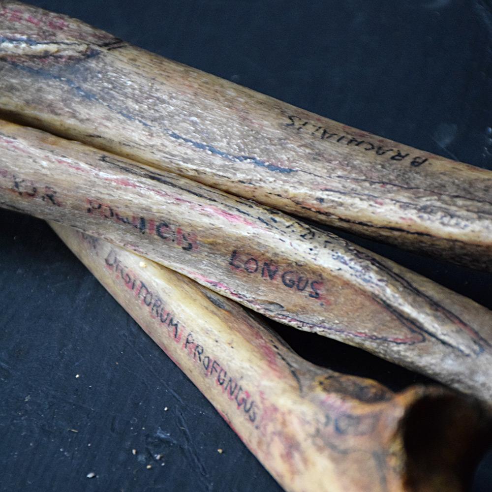 19th Century Half Human Medical Skelton 2