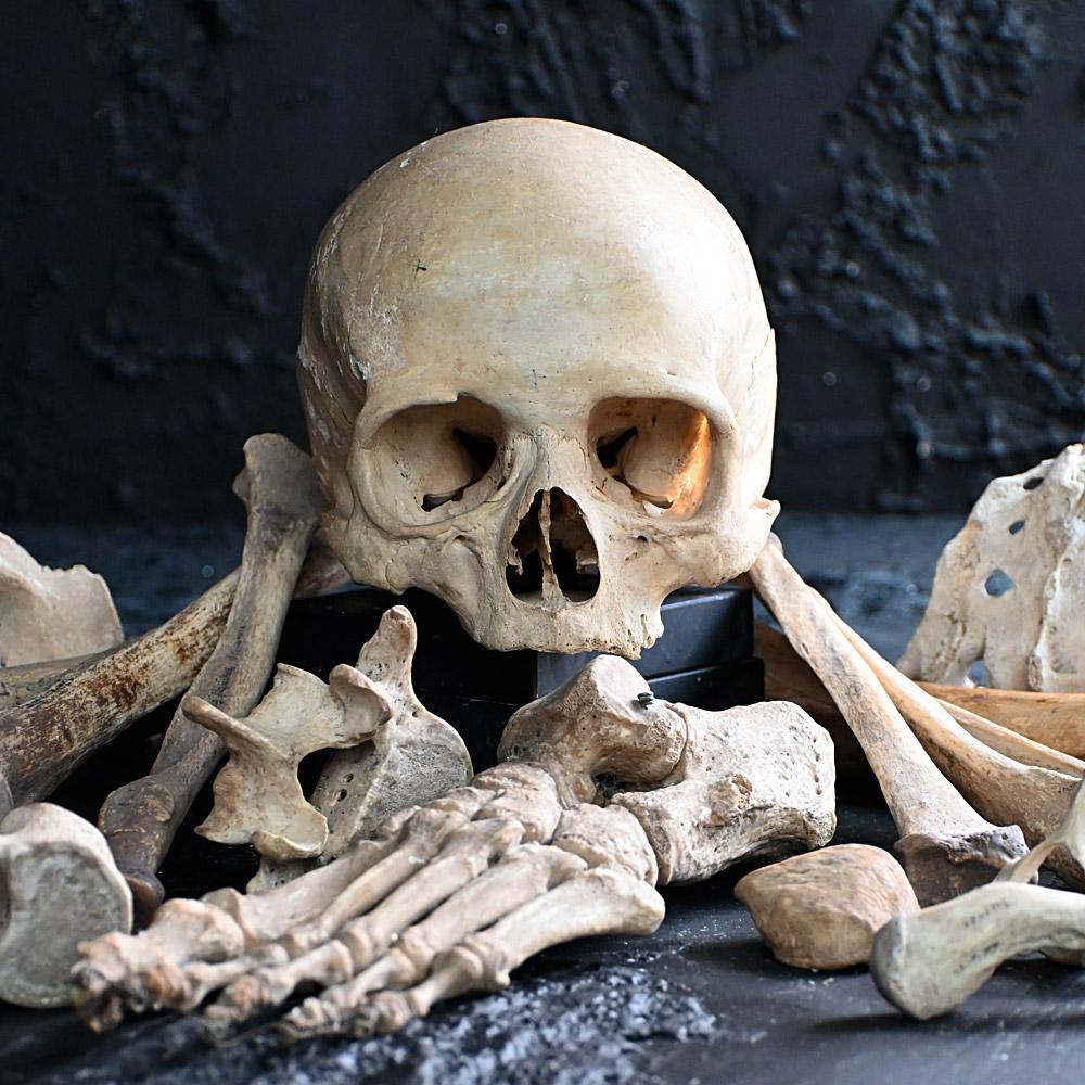 19th Century Medical Human Skull and Bones Artifacts 2