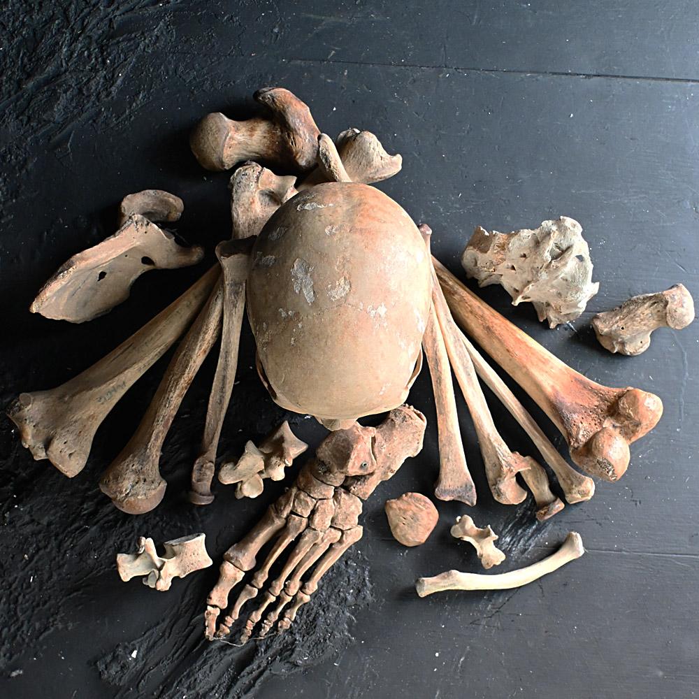 19th Century Medical Human Skull and Bones Artifacts 3