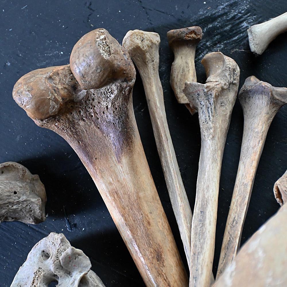 19th Century Medical Human Skull and Bones Artifacts 4
