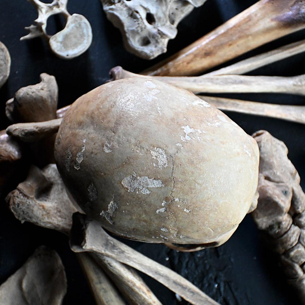 19th Century Medical Human Skull and Bones Artifacts 5