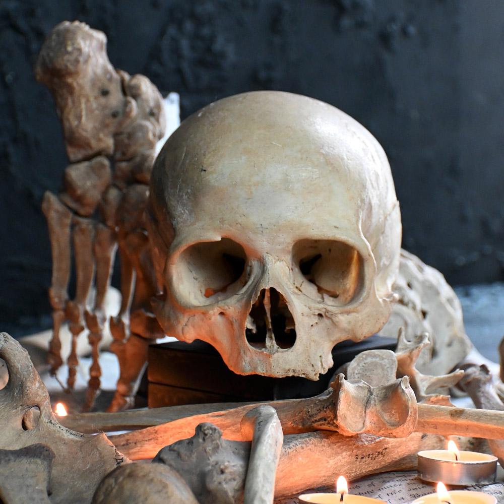 British 19th Century Medical Human Skull and Bones Artifacts