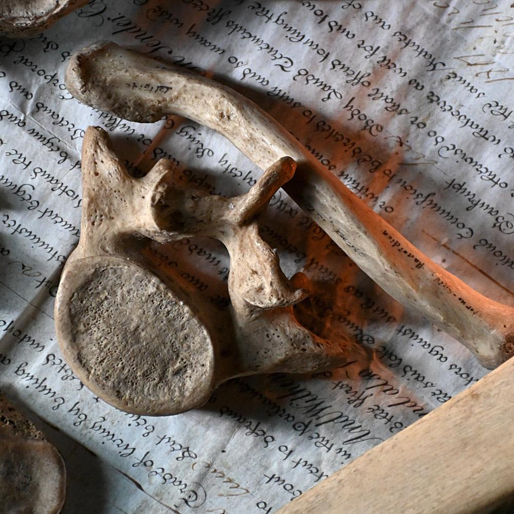 Mid-19th Century 19th Century Medical Human Skull and Bones Artifacts