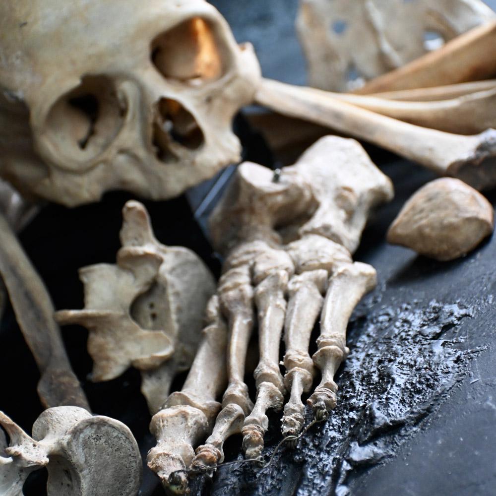 19th Century Medical Human Skull and Bones Artifacts 1