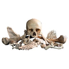 19th Century Medical Human Skull and Bones Artifacts